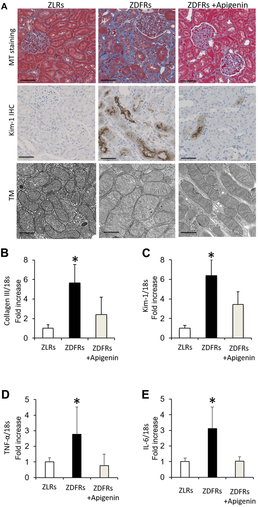 Apigenin ameliorates renal fibrosis and inflammatory gene expression in diabetic rats. (A) Representative photographs of MT staining (scale bar: 100 μm) and IHC of Kim-1 in the tubulointerstitial area (scale bar: 100 μm) and the mitochondrial morphology observed under transmission electron microscopy (TM) scale bar: 500 nm). (B–E) Quantitative RT-PCR of collagen III (B), Kim-1 (C), TNF-α (D), and IL-6 (E) mRNA normalized to expression of 18S, in the renal cortex (n=6). All data represent the mean ± standard deviation (SD). *p