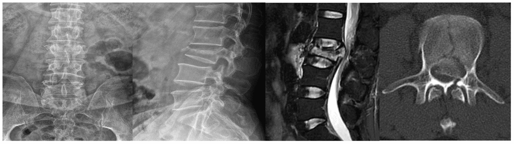 Lumbar X-rays, MRI, and CT examinations of the patient.