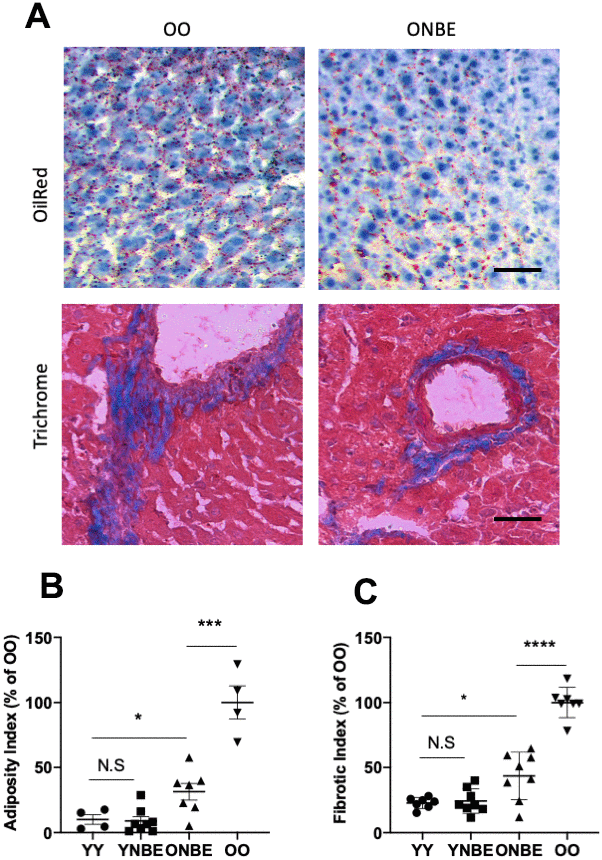 Liver adiposity and fibrosis are reduced in old mice after a single procedure of neutral blood exchange. Histological analysis (Oil Red-O and Masson’s trichome staining) of 10 μm liver sections from uninjured mice collected at 6 days after NBE. (A) Representative images of lipid droplets (fat) stained with Oil Red-O and Collagen (fibrosis) stained blue with Masson’s trichome show that NBE visibly reduced fat and fibrosis of old livers. (B) Adiposity Index (red pixels per section) and (C). Fibrotic index (numbers of fibrotic clusters per section) were determined as in [9] and by shown here trichrome. Adiposity: YY-YNBE NS p= 0.8, YY-ONBE *p= 0.04, OO-ONBE ***p= 0.0004. N=4 YY and OO, N=8 YNBE and ONBE. Fibrosis: YY-YNBE NS p= 0.7, YY-ONBE *p= 0.012, OO-ONBE ****p= 0.00001. N=8. All quants are represented as % of OO control. Scale bar=50 μm. Representative images for YY versus YNBE cohorts and of albumin/Hoechst are shown in Supplementary Figure 6.