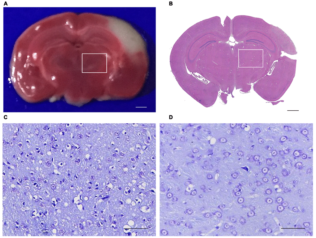 Triphenyltetrazolium chloride (TTC), Hematoxylin and eosin (H&E) and Nissl Staining of the brain section. (A) TTC staining showed the red region is normal brain tissue and the white region is infarction (bar=100μm). (B) H&E staining showed that the primary infarction is confined to the left cortex and does not involve the ipsilateral thalamus in mice (bar=100μm). (C, D) Nissling staining of the ipsilateral thalumus of the focal cortical infarction mice and sham mice (bar=50μm). (The rectangle indicates the non-ischemic ipsilateral thalamus).