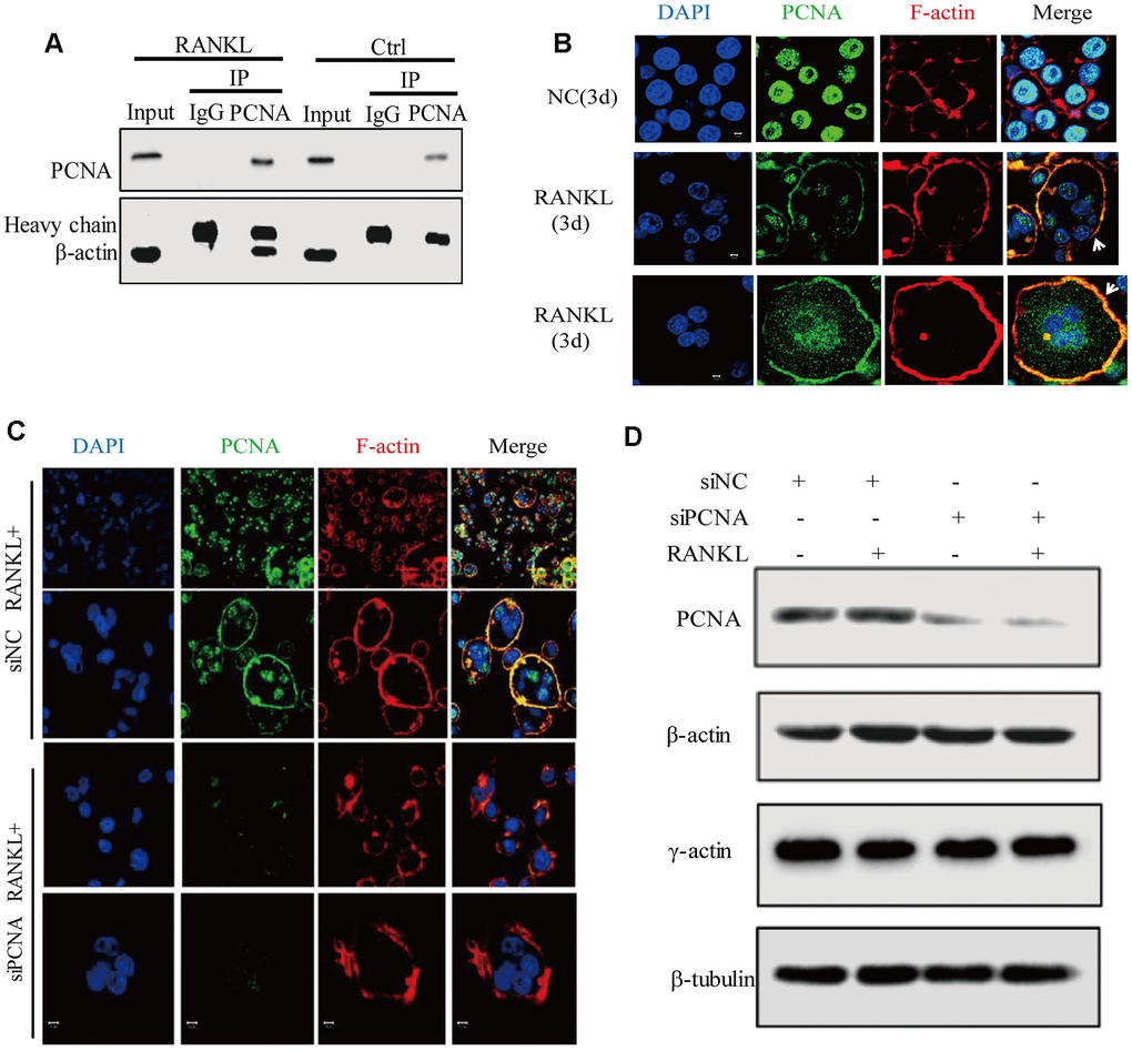 Cytoplasmic PCNA interacts with β-actin and is necessary for the integrity of actin belt. (A) Interaction between PCNA and β-actin in RANKL-induced RAW264.7 cells. RAW264.7 cells with or without RANKL (100 ng/mL) induction for three days were used to perform co-IP assay using IgG and primary PCNA antibody. Western blot assay was then carried out to detect PCNA and β-actin in the immune complexes. Heavy chain: the heavy chains of control IgG and PCNA antibody. (B) The subcellular localization of PCNA and F-actin. RAW264.7 cells with or without RANKL (100 ng/mL) induction for three days were used to perform IF experiments. PCNA was labeled by Alexa 488 (green). F-actin was dyed with phalloidine-conjugated Alexa Fluor 594 (red). The images of the two bottom panels were two different representative osteoclasts. Scar bar: 5μm. (C) The effect of knockdown PCNA on the integrity of actin belt. RAW264.7 cells were transfected with siRNA targeting PCNA for 48 hours, then, the cells were treated with RANKL (100 ng/mL) for 3 days and IF assay were performed to assess the integrity of actin belt. Scar bar: 5μm. (D) The effect of PCNA knockdown on the expressions of β-actin and γ-actin. RAW264.7 cells were transfected with PCNA siRNA and treated with RANKL (100 ng/mL) for 3 days. Then, the cells were harvested and lysed for standard western blot assay using the indicated antibodies.