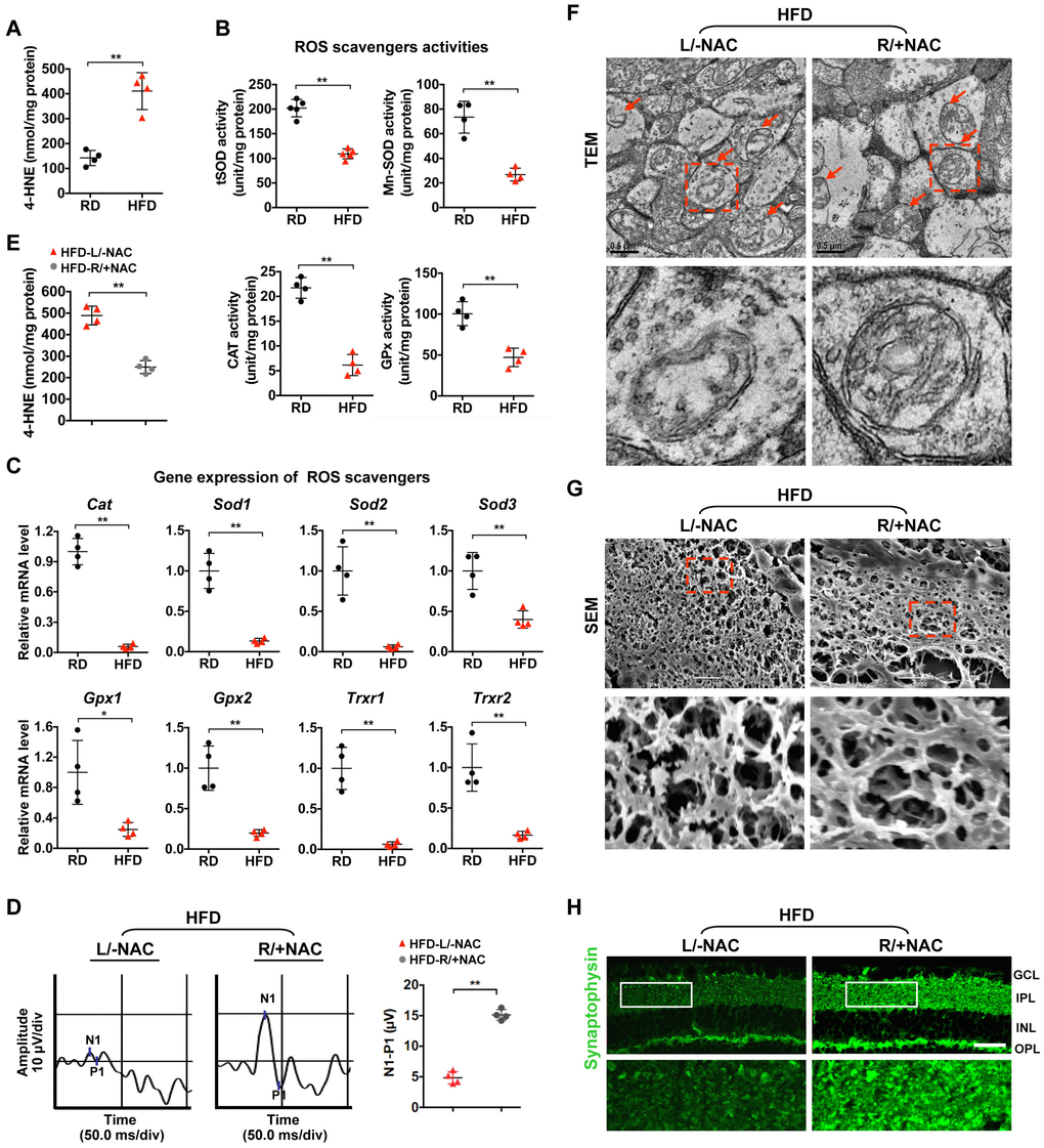 Oxidative stress causes mitochondrial defect and synaptic neurodegeneration in diabetic retinae. (A) Contents of 4-HNE in retinae. (B) Activities of antioxidant enzymes. (C) Expression of genes encoding ROS scavengers was determined by quantitative RT-PCR in retinae. The mRNA level of each gene was normalized to the internal GAPDH control and expressed as fold changes of mRNA abundance in the retina from HFD groups relative to their age-matched RD controls. (D–H) 1 μl of NAC (500 nM) was injected intravitreally into the right eye of HFD-induced diabetic mice (HFD-R/+NAC), while PBS was injected into the contralateral left eye as a control (HFD-L/-NAC). (D) Representative waveforms of VEP and quantification of differences in peak amplitude (N1-P1). (E) Contents of retinal 4-HNE. (F) Representative images of retinal TEM with mitochondria in IPL (arrows). Areas boxed in are shown at higher magnification in the lower panels. Scale bar, 0.5 μm. (G) Representative SEM of retinal sections. Areas boxed are shown at higher magnification. Scale bar, 10 μm. (H) Representative synaptophysin (green; scale bar, 100 μm) immunostaining in retinae. Areas boxed in are shown at higher magnification in the lower panels. Data are means ± SEM. n = 4 mice (A–C) or n = 4 eyes (D–H) per group. **P *P **P Supplementary Figures 2B and 3B.