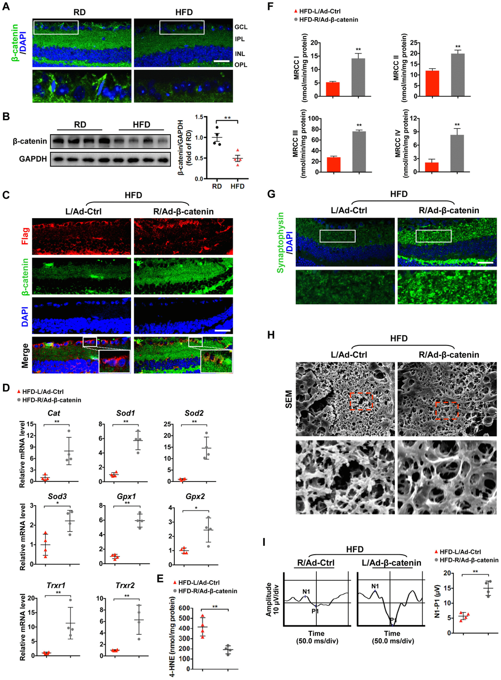 β-catenin downregulation triggers oxidative stress-induced mitochondrial damage and synapse degeneration in diabetic retinae. (A) Representative retinal immunofluorescence for active β-catenin (green) from mice fed with RD or HFD. Nuclei were counterstained with DAPI (blue). Areas boxed in are shown at higher magnification in the lower panels. Scale bar, 100 μm. (B) Western blotting of active β-catenin in total retina lysate. Intensities were quantified and normalized against the level of GAPDH and expressed as fold changes of protein abundance in the retina from HFD groups relative to RD controls. (C–I) An adenovirus coding for β-catenin with Flag tag was injected intravitreally into the right eye of HFD-fed mice (HFD-R/Ad-β-catenin), while an empty control vector was injected into the contralateral left eye as a control (HFD-L/Ad-Ctrl). (C) Retinal double-immunostaining for Flag (red) and active β-catenin (green). Areas boxed in are shown at higher magnification. Scale bar, 100 μm. (D) Relative mRNA expression of genes encoding ROS scavengers. (E) Contents of 4-HNE in retinae. (F) Activities of retinal mitochondrial complex MRCC I-IV. Two retinae from 2 respective eyes in one group were pooled. Three independent experiments were performed in duplicate for each group. (G) Representative retinal immunostaining for synaptophysin (green; scale bar, 100 μm). Areas boxed in are shown at higher magnification in the lower panels. (H) Representative SEM of retinal sections. Areas boxed are shown at higher magnification. Scale bar, 10 μm. (I) Representative VEP waveforms and quantification of peak amplitude difference (N1-P1). Data are means ± SEM. n = 4 mice (A–B), n = 4 eyes (C–E; G–I), or n = 6 eyes (F) per group. **P *P **P Supplementary Figures 2C, 3C, 4A, and 4B.