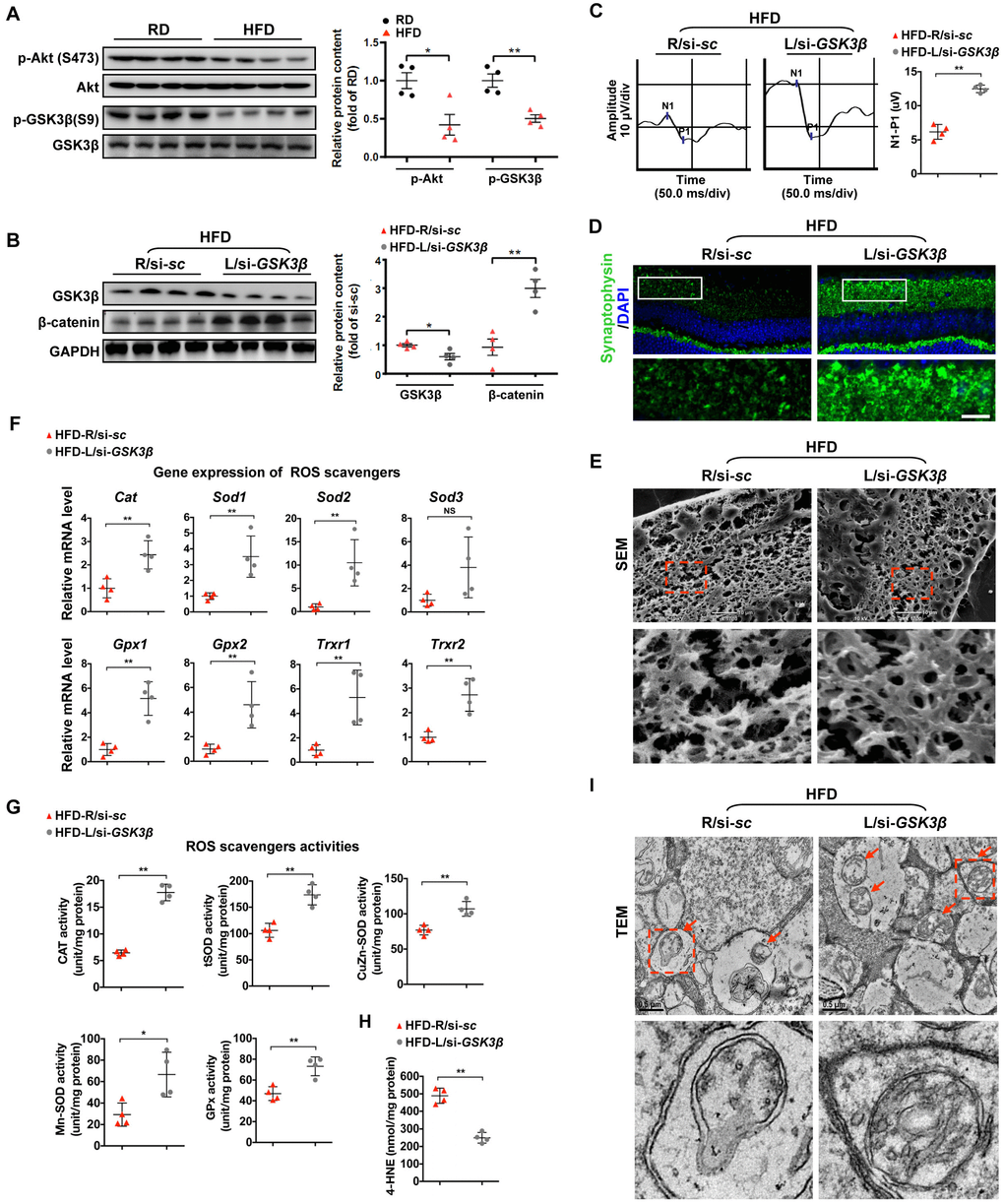 Restoring β-catenin by GSK3β inhibition protects diabetic retinae from mitochondrial and synaptic defect. (A) Western blotting analyses of phosphorylated-Akt (S473), Akt, phosphorylated-GSK3β (S9), and GSK3β in retinae from mice fed with RD or HFD, respectively. Relative intensities were quantified and normalized against the level of Akt or GSK GSK3β, respectively. (B–I) si-GSK3β was intravitreally injected in the left eye of HFD-fed mice (HFD-L/si-GSK3β), while a scramble si-sc was injected in the contralateral right eye as a control (HFD-R/si-sc). (B) Western blotting for GSK3β and active β-catenin. Relative intensities were quantified. (C) Representative waveforms of VEP and quantification of differences in peak amplitude (N1-P1). (D) Retinal immunostaining for synaptophysin (green; scale bar, 100 μm). Areas boxed in are shown at higher magnification. (E) Representative images of retinal SEM. Lower panels are high-power magnification of boxed areas. Scale bar, 10 μm. (F) Relative mRNA expression of ROS scavenging genes in retinae. (G) Activities of antioxidant enzymes in retinae. (H) Contents of retinal 4-HNE. (I) Representative images of retinal TEM with mitochondria in IPL (arrows). Areas boxed in are shown at higher magnification. Scale bar, 0.5 μm. Data are means ± SEM. n = 4 mice (A) or n = 4 eyes (B–I) per group. *P **P *P **P sc. NS, no significant difference. See also Supplementary Figures 2D and 3D.