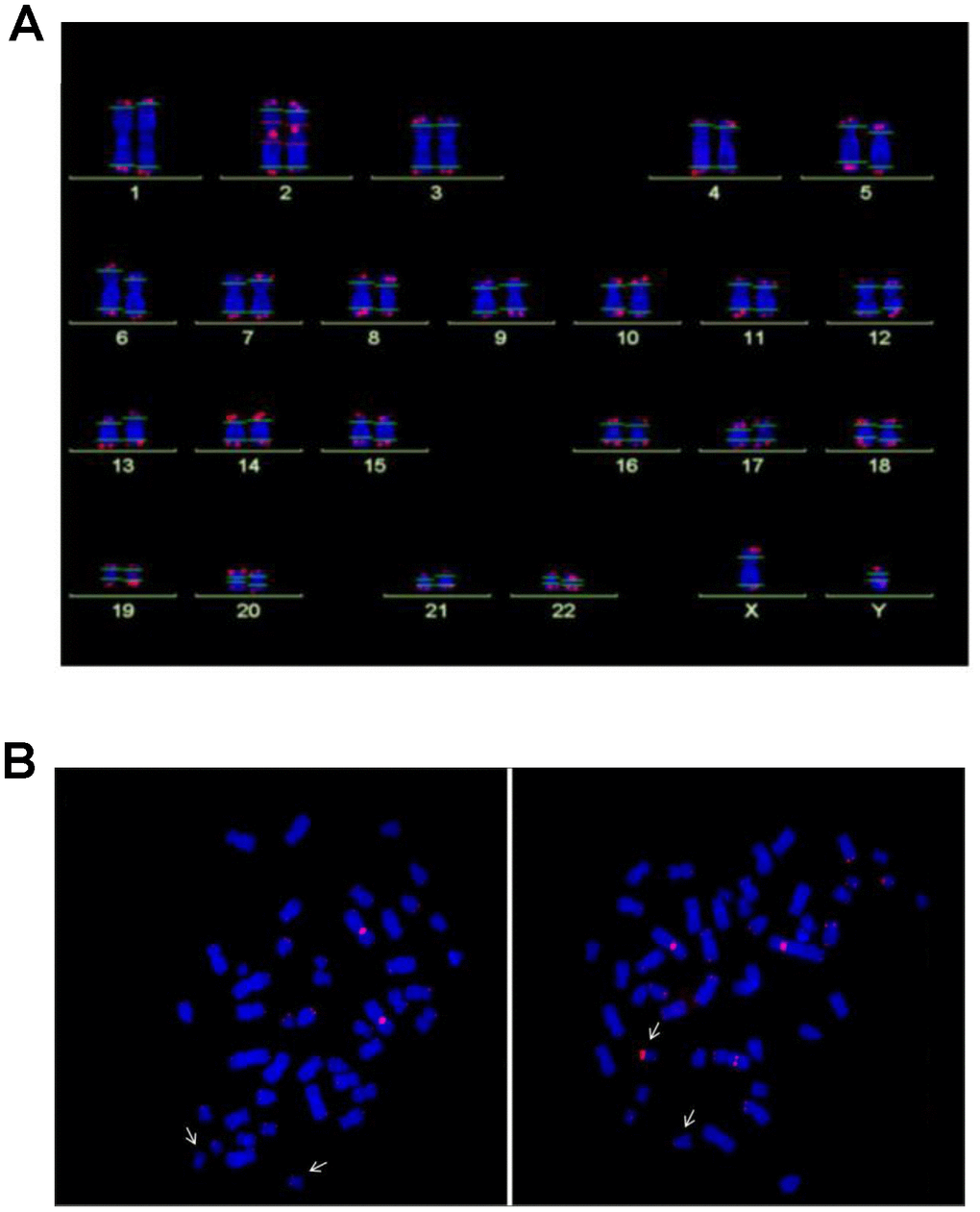 (A) Analysis of telomere length by Q-FISH. Normal karyogram with single telomeres stained for telomere repeats (Q-FISH) and a repetitive region in the centromeric region of chromosome 2. The horizontal lines overlaid on each chromosome define the measurement areas. (B) Metaphases of the NBS LCL 94P0307 after Q-FISH of the NBS cell line 94P0307 with very short telomeres and a telomere fusion. The arrows point to chromosomes 19. Left panel, Metaphase with weak telomerice fluorescence of both chromosomes 19; Right panel, Metaphase with one chromosome 19 with a brightly fluorescent telomere of the p-arm. The other bright signal is the reference region of chromosome 2. Original after thesis Raneem Habib [28].