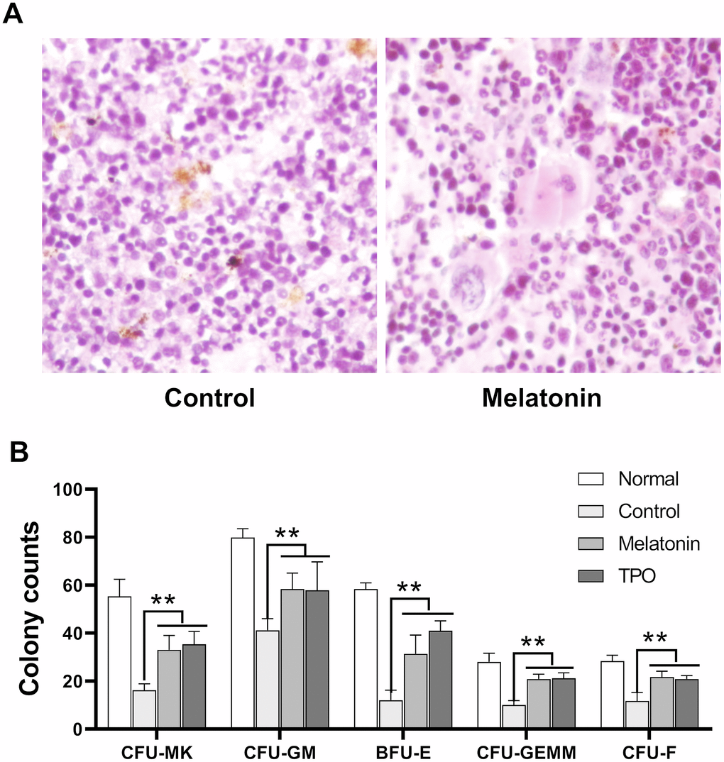 Melatonin promotes the formation of CFU. The number of CFUs was scored after melatonin (100 nM) or TPO (positive control, 50 ng/mL) treatments for seven days (n=6). (A) Bone marrow histology of Giemsa staining. (B) Statistic analysis of CFUs. Two-way ANOVA (with a Tukey multiple comparison test) was employed to test for significance (n=6). ** p