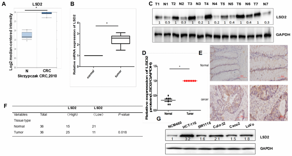 LSD2 expression levels in human colorectal cancer (CRC) tissue and cells. (A) The ONCOMINE database was used to examine mRNA expression of LSD2 in CRC tissue. (B) Real-time Polymerase chain reaction (PCR) to evaluate mRNA expression of LSD2 in clinical CRC specimens relative to normal tissues (n=36). Data were expressed as means ± SEM. (C, D) Western Blot evaluation of LSD2 protein expression in CRC and normal tissue. (E) LSD2 protein expression in normal and CRC tissue was analysed by IHC. (F) Pearson’s χ2 tests to assess the association between colon tissue type and LSD2 expression by IHC(n=36). (G) Western blotting to assess LSD2 expression in CRC cell lines.