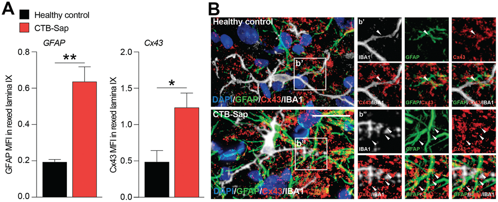 Increase of Cx43 in the spinal cord cell populations of motoneuron-depleted spinal cord. (A) Quantification of mean fluorescence intensity (MFI) of GFAP and Cx43 in the left lamina IX of healthy control and CTB-Sap lesioned mice; data are expressed as mean ± SEM; **p-value B) Representative confocal images of Cx43 (red) immunofluorescence analysis in lamina IX of healthy control and CTB-Sap lesioned mice; images show also markers for astroglial cells (GFAP, green) and microglia (IBA1, white); scale bar 20 μm.