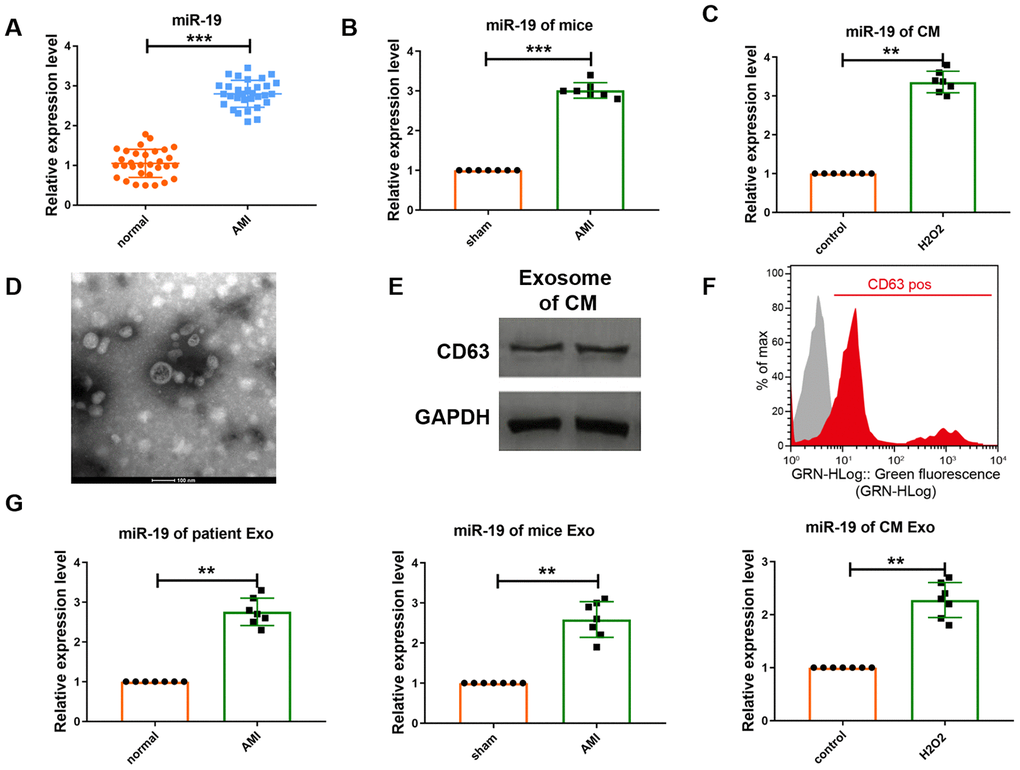 Expression level of miR-19a-3p is upregulated in response to MI or H2O2.. (A–C) qRT-PCR analysis of miR-19a-3p level in patients’ serum, mice serum and culture medium of CM. U6 was used as the control. (D) Electron microscopy image of CM–derived exosomes, showing a size of approximately 30 to 150 nm in diameter. Scale bar: 100 nm. (E) Western blot analysis of the protein level of CD63. (F) Flow cytometry analysis of CD63 of CM-derived exosomes. CM-derived exosomes were immunostained against CD63 (red curve) and compared with the appropriate isotype control (gray curve). (G) qRT-PCR analysis of miR-19a-3p level in exosomes derived from patients’ serum, mice serum and culture medium of CM. U6 was used as the control. **P P 