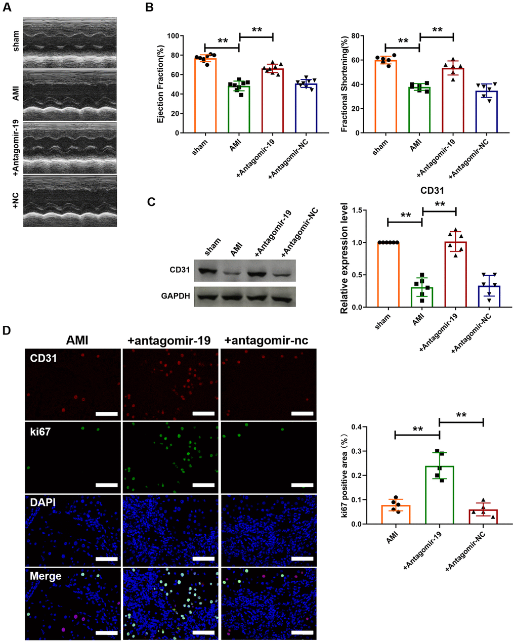 Inhibition of miR-19a-3p promotes angiogenesis and improves heart function in mice with MI. (A) Representative echocardiographic assessment images of heart function of mice with MI. (B) Ejection fractions (EF%) and fractional shortening (%). (C) Western blot analysis of expression level of CD31 in left ventricle of mice. (D) Immunofluorescence staining of ki67 in peri-infarct area of left ventricle. **P 
