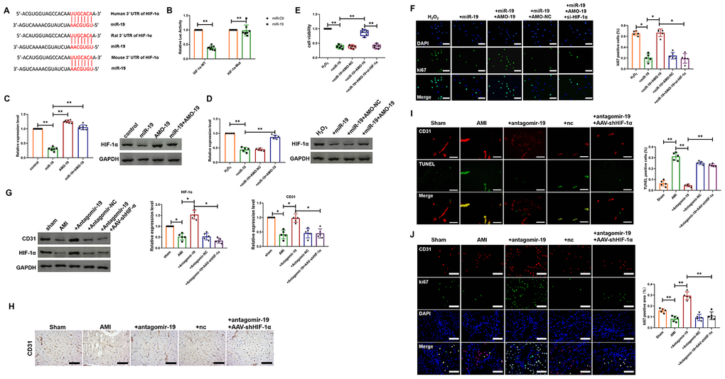 miR-19a-3p reduces endothelial cells proliferation and attenuates heart function by targeting HIF-1α. (A) The predicted binding site of miR-19a-3p on the 3’ UTR of HIF-1α gene. (B) Luciferase reporter activities of chimeric vectors carrying the luciferase gene and a fragment of the 3’ UTR of HIF-1α containing the wild type or mutant miR-19a-3p binding sites. (C) Western blot analysis of expression level of HIF-1α of endothelial cells transfected with miR-19a-3p or AMO-19. (D) Western blot analysis of expression level of HIF-1α of endothelial cells in response to H2O2 treatment with or without transfection of miR-19a-3p or AMO-19. (E) MTT assay of endothelial cells in response to H2O2 treatment with or without transfection of miR-19a-3p or AMO-19. (F) Immunofluorescence staining of ki67 in endothelial cells in response to H2O2 treatment with or without transfection of miR-19a-3p or AMO-19. (G) Western blot analysis of expression level of CD31 and HIF-1α in left ventricle of mice with or without MI. (H) Immunohistochemical staining of CD31 level in mice after MI. (I) TUNEL staining was performed to measure the level of endothelial cell death. (J) Immunofluorescence staining of ki67 in peri-infarct area of left ventricle. *P P 