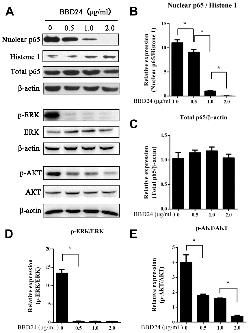BBD24 down-regulated NF-κB, ERK and AKT signaling pathways of HOS cells. The cells were treated with BBD24 at indicated concentrations for 48 hours, and then nuclear and cytoplasmic proteins were extracted for western blot analysis. β-actin and histone 1 were used as cytoplasmic and nuclear loading controls, respectively. (A–E) BBD24 treatment reduced nuclear NF-κB p65 protein level, and inhibited activation of ERK and AKT of HOS cells in dose-dependent manners. Results were expressed as means ± SD of three independent experiments. * P