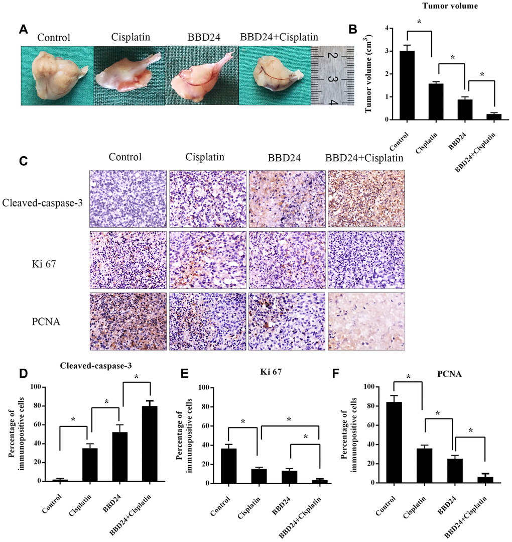 in vivo anti-tumor activity of BBD24. Nude mice were treated with BBD24 and/or cisplatin for 20 consecutive days. (A, B) Tumor volumes in control, cisplatin, BBD24 and BBD24+cisplatin groups. (C–F) Immunohistochemical staining of Cleaved-caspase-3, Ki-67 and PCNA in different groups. Results were expressed as means ± SD of three independent experiments. * P