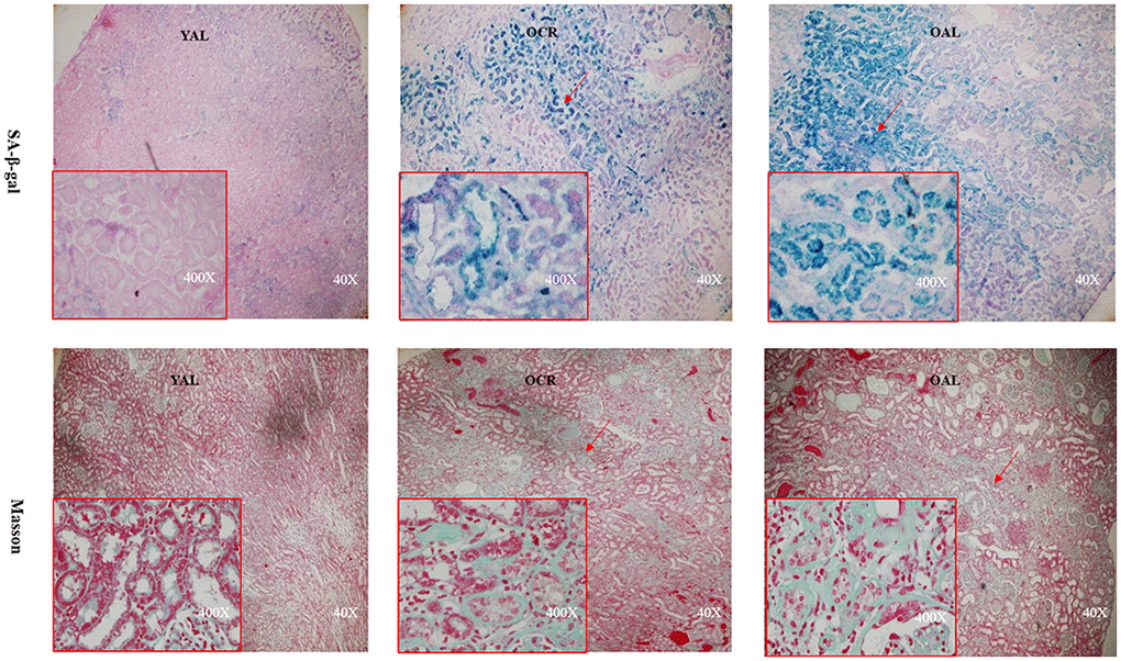 Renal cortex from three groups. The sections were stained with SA-β-gal and Masson’s trichrome staining for the assessment of kidney morphology changes (× 40/ 400 magnification).