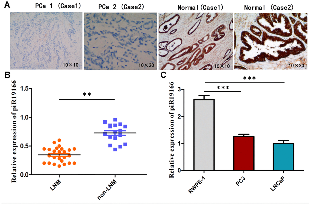 Expression of piR-19166 in PCa tissues and cell lines. (A) ISH showed expression of piR-19166 was negative (30/42) compared with the adjacent normal tissues (positive, 35/42). (B) Compared with the negative group of lymph node metastasis (LNM), a significantly low level of piR-19166 was detected in the LNM -positive group by qRT-PCR (Pearson Chi-Square=42.000, **PC) Down-regulation of piR-19166 was detected using qRT-PCR in PC3 (T test, t=33.15, ***P 