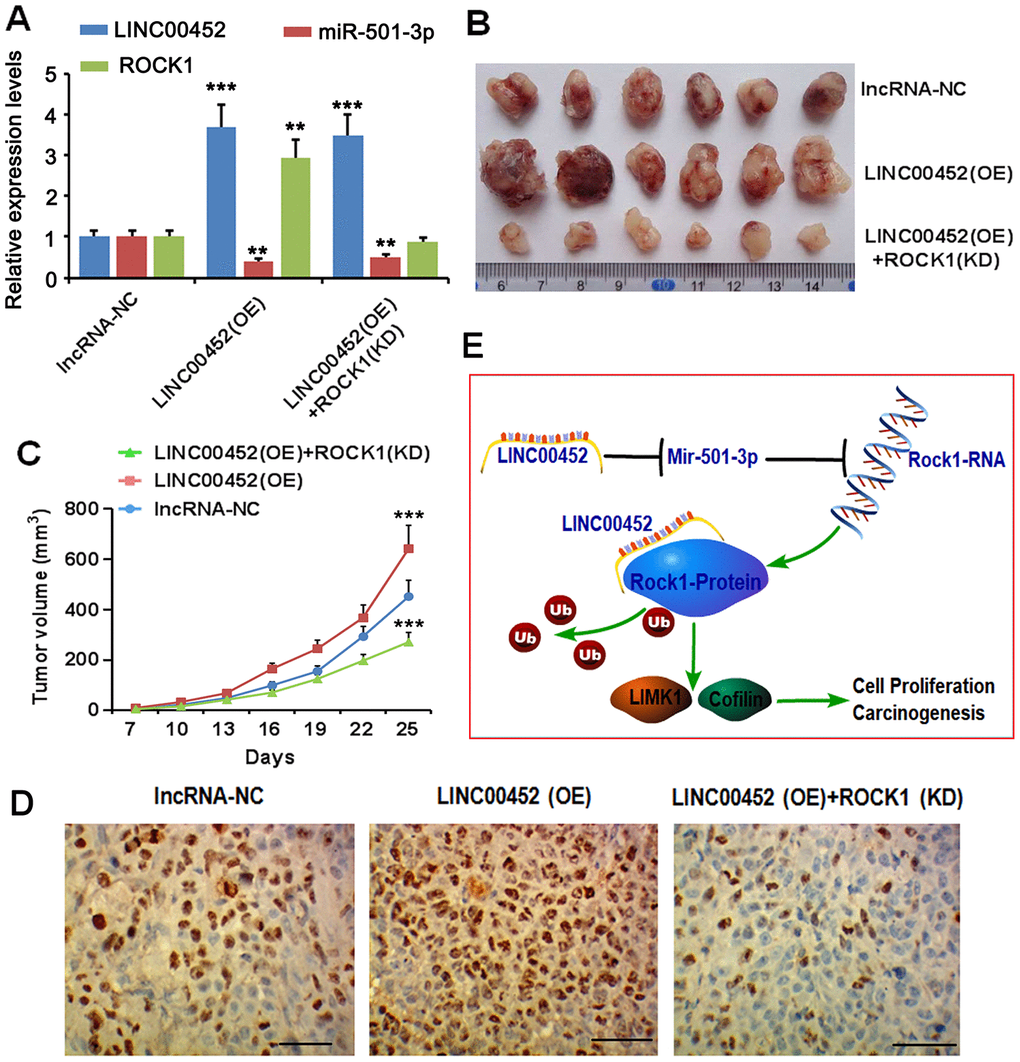 LINC00452 promotes xenograft tumor growth in vivo. (A) CaOV3 cancer cells with stable transfection of negative control lncRNA, LINC00452 as well as LINC00452 in combination with ROCK1-shRNA were subcutaneously injected into nude mice, respectively. PCR assay was performed to detect LINC00452, miR-501-3p and ROCK1 expression. (B) Tumor growth curves as recorded by measuring tumor volume. Overexpressing LINC00452 promoted tumor growth, which was abolished upon knockdown (KD) of ROCK1. *** p C) Representative images showing xenograft tumors. (D) Immunohistochemistry results showing overexpressing LINC00452 promoted cell proliferation in tumors as indicated by more Ki67-positive cells. Knockdown (KD) of ROCK1 dramatically decreased number of Ki67-positive cells. (E) Diagram image showed that the carcinogenicity of LINC00452 is partially due to competitive sponging of miR-501-3p followed with release of repression on the ROCK1, a key effector in Rho signaling pathway. Irrespective of its miRNA sponge function, LINC00452 is capable of preventing ROCK1 protein from ubiquitin/proteasome-mediated degradation via their mutual physical interaction.