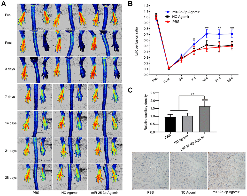 MiR-25-3p can promote ischemia-initiated blood flow recovery and angiogenesis in aged mice. (A) Representative images of laser Doppler blood flow before, immediately after, and 3, 7, 14, 21 and 28 days after femoral artery resection. (B) Blood flow in the ischemic hind limb was measured. The results are expressed as a ratio of the perfusion in the left limb (ischemic) to that in the right limb (control, nonischemic). The recovery of lower limb blood flow in the miR-25-3p agomir group (n=5) was better than that in the NC agomir group (n=5) and the PBS group (n=5) on the 7th, 14th and 28th days. (C) Representative images of anti-CD31 immunohistochemical sections of the gastrocnemius muscle of the left lower extremity. The expression level of CD31 in the miR-25-3p agomir group was higher than those in the NC agomir and PBS groups. For each animal, 5-6 randomly selected fields from 3-5 sections were counted (*P 