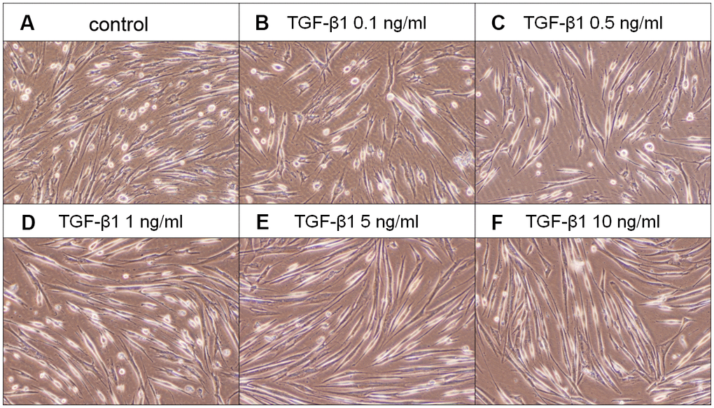Effect of TGF-β1 on the morphology of SHED. (A) Control SHED, exposure to (B) 0.1 ng/ml TGF-β1, (C) 0.5 ng/ml TGF-β1, (D) 1 ng/ml TGF-β1, (E) 5 ng/ml TGF-β1 and (F) 10 ng/ml TGF-β1 for 5 days. One representative morphologic picture of cells was shown.