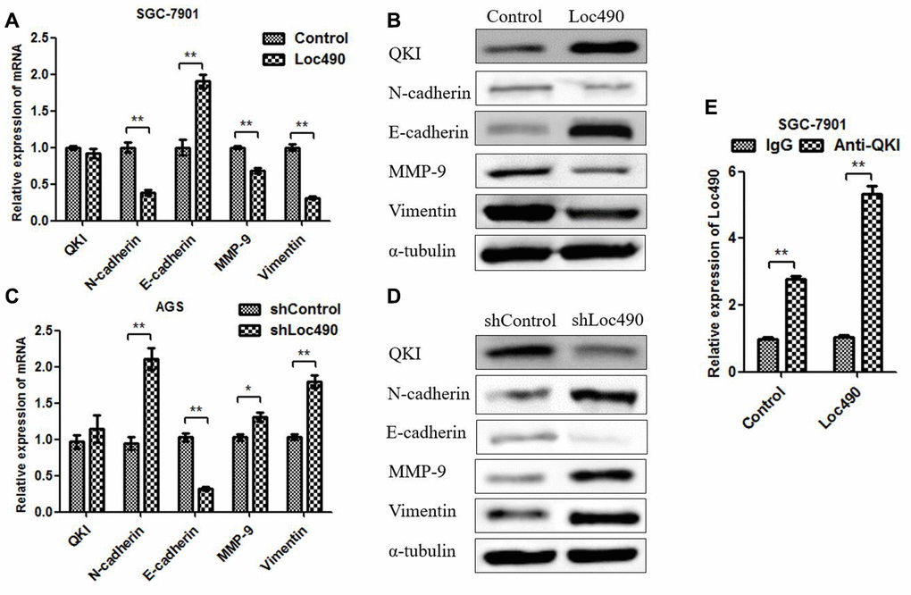 The expression of Loc490 changes the expression of EMT-related proteins. (A, C) Changes in QKI, N-cadherin, E-cadherin, MMP-9 and Vimentin mRNA levels in Loc490-overexpressing cell lines; (B) Changes in QKI, N-cadherin, E-cadherin, MMP-9 and Vimentin protein levels in Loc490-overexpressing cell lines; (D) Changes in QKI, N-cadherin, E-cadherin, MMP-9 and Vimentin protein levels in Loc490-knockdown cell lines; (E) RNA immunoprecipitation assay to detect Loc490 expression. Data represent the mean and SD from three experiments. *p 