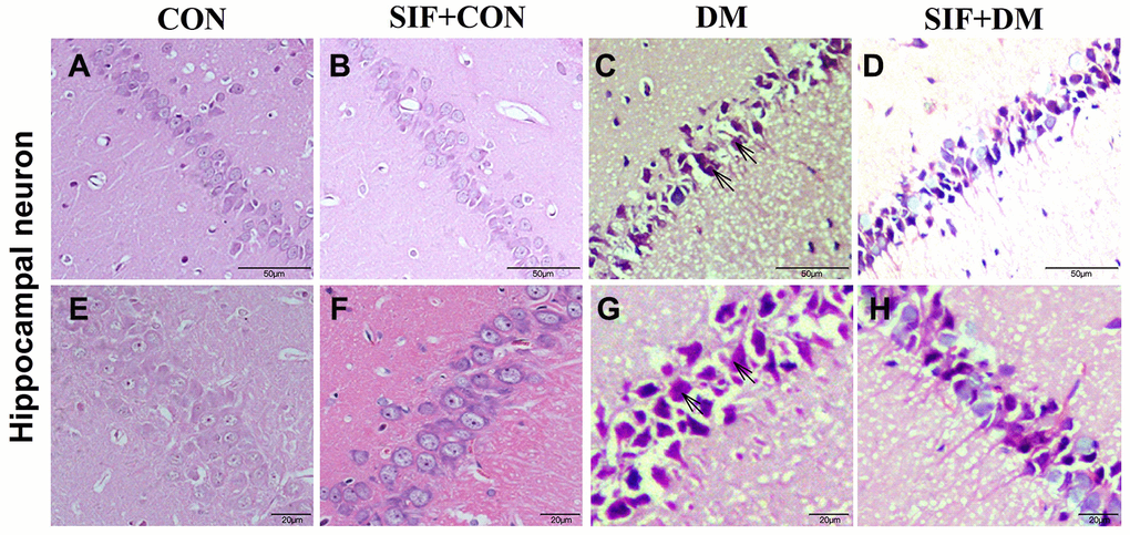 SIF inhibited neuron loss after 4 weeks of treatment. HE staining was performed on the sections of the rat hippocampus. (A–D) Representative hippocampal photomicrographs of the four groups, 4x, scale bar = 50 μm; (E–H) Representative hippocampal photomicrographs of the four groups, 40x, scale bar = 20 μm. The arrows indicate positive signs of hippocampal neurons (shrunken or irregular shape and deeper staining).