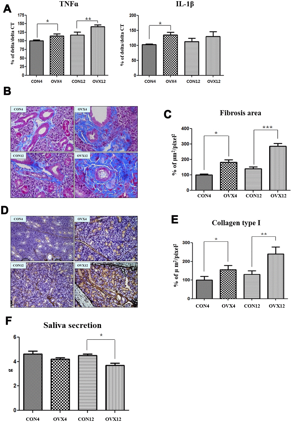 Increased salivary gland fibrosis and decreased salivary gland function. (A) Real time PCR of TNFα and IL-1β mRNA expression in the CON and OVX groups. (B) Fibrosis of submandibular gland detected by Masson and trichrome's staining. (C) Morphometric analysis of fibrosis in submandibular gland tissue in the CON and OVX groups. (D) Collagen type I expression of submandibular gland detected by immunohistochemistry. (E) Morphometric analysis of expression of collagen type I in the CON and OVX groups. (F) Saliva secretion in the CON and OVX groups. Two-way ANOVA test. *ppp