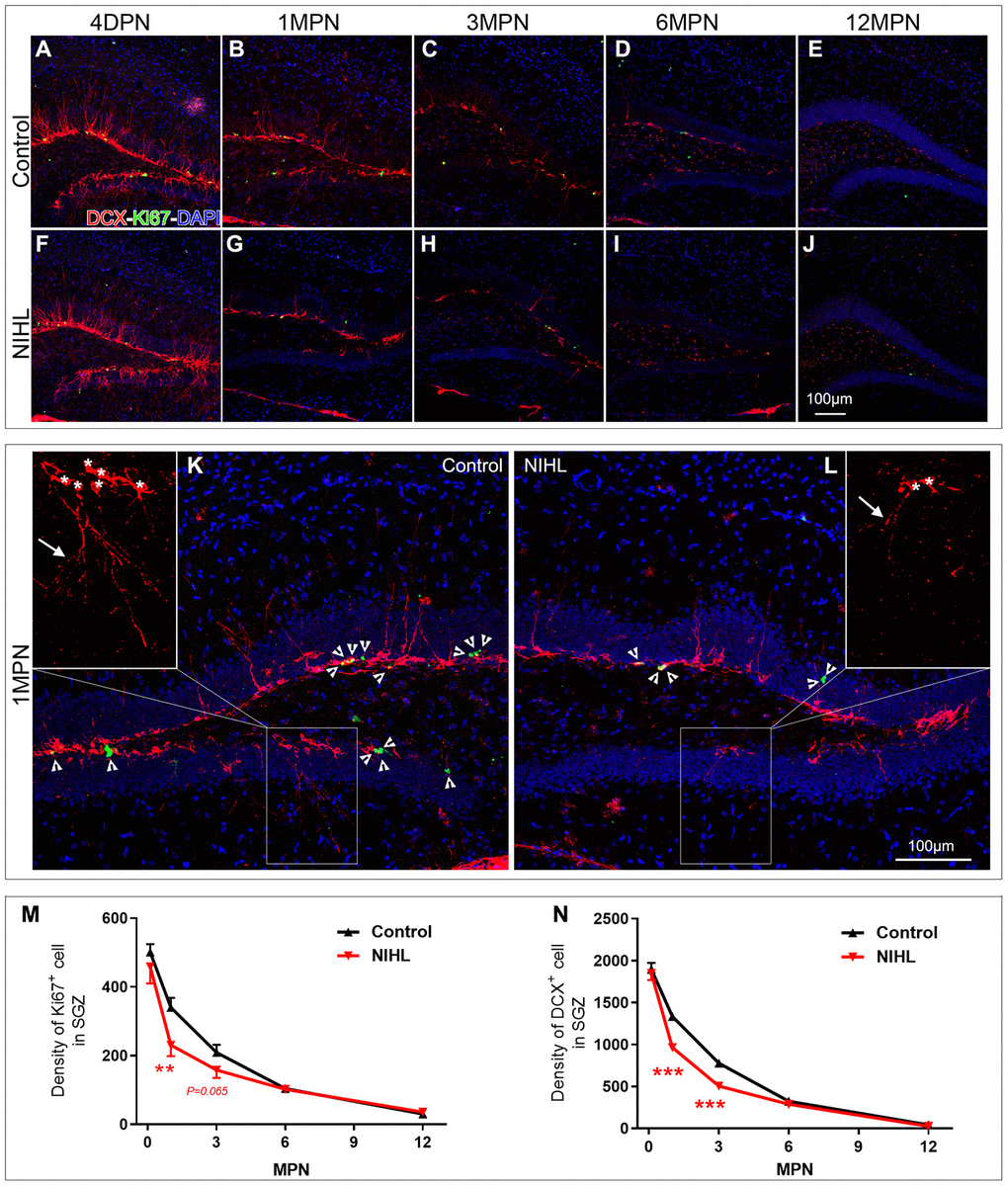 NIHL mice exhibited an accelerated age-related decline in hippocampal neurogenesis. (A–J) Representative images of Ki67+ (green) and DCX+ (red) cells in the hippocampal DG of control and NIHL mice at 4 DPN (A, F), 1 MPN (B, G), 3 MPN (C, H), 6 MPN (D, I) and 12 MPN (E, J). Note the accumulation of autofluorescent lipofuscin deposits (red), a sign of normal senescence [43], in the DG of control and NIHL mice at 6 MPN and 12 MPN. Scale bar: 100 μm. (K, L) Enlarged views of B (K, flipped horizontally) and G (L). Arrowheads indicate Ki67+ (green) cells. Asterisks and arrows in the magnified inserts indicate the soma and processes of DCX+ cells (red). Note the obvious reduction in branch complexity of DCX+ cells in NIHL mice. Scale bar: 100 μm. (M, N) Quantitative analyses of Ki67+ cells (M) and DCX+ cells (N) in the DG of mice at different time points. **Ppost hoc Tukey’s test, vs. age-matched control group).
