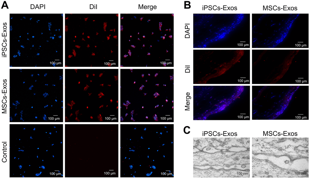 Uptake of iPSCs/MSCs-Exos. (A) Immunofluorescence staining of HCECs. HCECs were treated with 25 μg/ml DiI-labeled iPSCs/MSCs-Exos for 24 h. PBS, which was used to resuspend exosomes, was used as a negative control. Photomicrographs showed that red fluorescent particles were present throughout the cell cytoplasm, meaning that the exosomes were taken up by HCECs. (B) Immunofluorescence staining of rat corneal epithelium. After dropping DiI-labeled iPSCs/MSCs-Exos on rat cornea for 24 h, the corneas were harvested for immunofluorescence staining. The images of the whole mount of cornea showed a wide distribution of exosomes throughout the rat corneal epithelium, indicating successful fusion and uptake of iPSCs/MSCs-Exos by the corneal epithelium in vivo. (C) Exosome-like vesicles were detected by TEM on corneal epithelium. The diameters of the vesicles were between 100-200 nm.