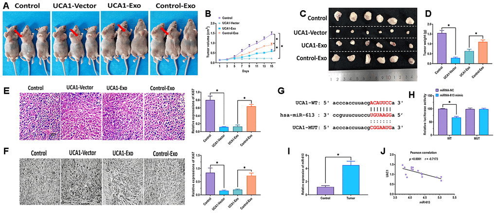 Effect of exosomal UCA1 on tumor growth in vivo. (A) Representative images of nude mice treated with EC18 cells transfected with UCA1-expressing vector (UCA1-vector) or negative control vector (Control), or exosomes derived from NEEC cells transfected with UCA1-expressing plasmids (UCA1-Exo) or negative control plasmids (Control- Exo). (B) Tumor volumes of mice treated with EC18 cells transfected with UCA1-expressing vector (UCA1-vector) or negative control vector (Control), or exosomes derived from NEEC cells transfected with UCA1-expressing plasmids (UCA1-Exo) or negative control plasmids (Control- Exo). (C, D) Representative images of tumor tissues and tumor weights of mice treated with EC18 cells transfected with UCA1-expressing vector (UCA1-vector) or negative control vector (Control), or exosomes derived from NEEC cells transfected with UCA1-expressing plasmids (UCA1-Exo) or negative control plasmids (Control- Exo). (E) H&E staining assay for Ki67 expression in tumor tissues. (F) Immunohistochemistry assay for Ki67 expression in tumor tissues. (G) Putative binding site of miRNA-613 in UCA1. (H) Luciferase reporter assay. (I) Expression of miRNA-613 in esophageal cancer tissues (Tumor) and paired normal tissues (Control). (J) Pearson’s correlation between expressions of miRNA-613 and UCA1 in esophageal cancer tissues. (*) denotes the difference between groups (P