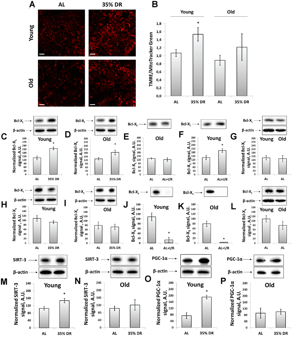 Evaluation of the mitochondrial potential, anti-apoptotic and pro-apoptotic proteins, the intensity of mitochondrial biogenesis, and the levels of mitochondrial deacetylase SIRT-3. (A) Confocal microscopy of vital kidney slices loaded with mitochondrial probe TMRE. Scale bar, 100 μm; (B) Mitochondrial membrane potential estimated by TMRE fluorescence intensity normalized to MitoTracker Green fluorescence intensity; (C, D) Levels of Bcl-XL in kidney tissue of young and old rats after DR; (E, F) Levels of Bcl-XL in kidneys of young and old rats in response to I/R; (G) Comparison of Bcl-XL levels in kidney tissue of young and old rats; (H, I) Levels of Bcl-Xs in kidney tissue of young and old rats after the DR; (J, K) Levels of Bcl-Xs in kidney tissue of young and old rats in response to I/R; (L) Comparison of Bcl-XS levels in kidney tissue of young and old rats; (M, N) Levels of SIRT-3 in kidney tissue of young and old rats after the DR; (O, P) Levels of PGC-1α in kidney tissue of young and old rats after the DR. *p 