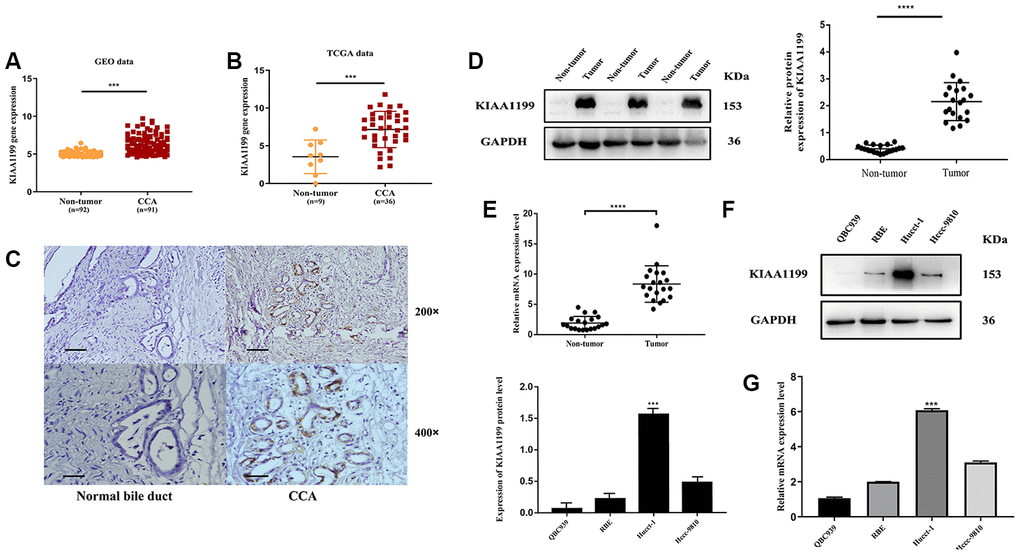 Bioinformatics prediction. (A) GEO: (GSE76297), Normal: n=92, CCA: n=91, (pB) TCGA database, Normal: n=9, CCA: n=36, (pC) The relative expression levels of KIAA1199 in Pathological sections. (D) The relative protein expression levels of KIAA1199 in 20 pairs of CCA and adjacent normal tissues(pE) The relative mRNA expression levels of KIAA1199 in 20 pairs of CCA and adjacent normal tissues(pF, G) The relative protein and mRNA expression of KIAA1199 in four CCA cell lines.