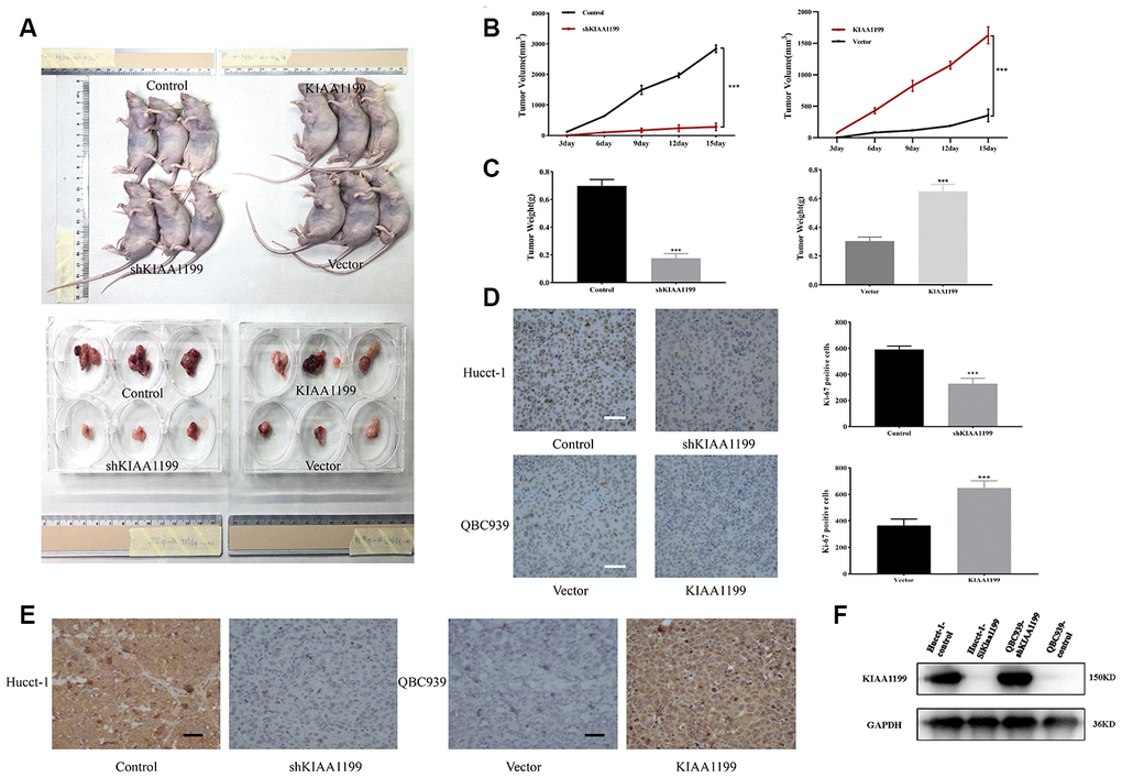 (A) Xenografts were established in nude mice with stable KIAA1199 knockdown or overexpression cell. KIAA1199 knockdown decreased the volume (B) and weight (C) of xenograft tumors. KIAA1199 overexpression increased the volume and weight of xenograft tumors. Tumor diameter was measured every 3 day. (D) Ki67 staining showed that KIAA1199 can improve the proliferation ability of xenograft tumors. (E, F) Immunohistochemistry and WB detected the expression of KIAA1199 in xenograft tumors. *, ** and *** represented P