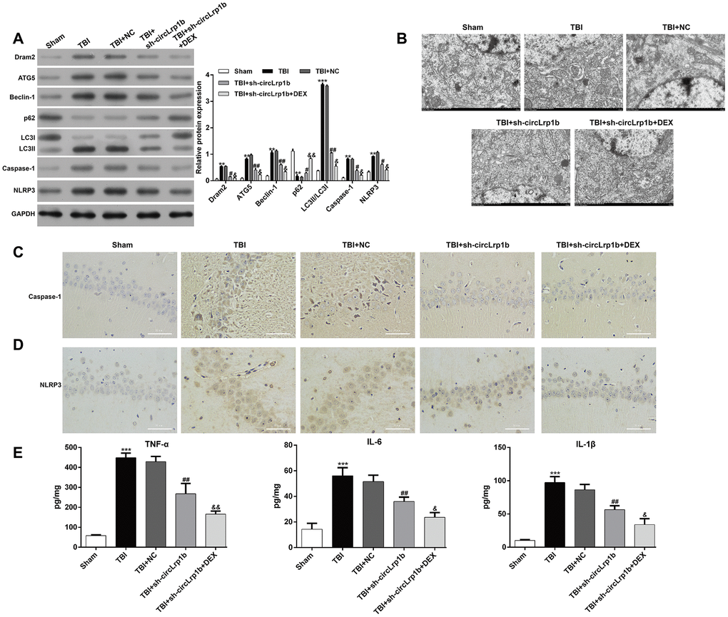 Down-regulation of circLrp1b enhances the effects of dexmedetomidine in reducing traumatic brain injury-induced autophagy and inflammation. Rats were administered an intracerebroventricular injection of sh-circLrp1b before traumatic brain injury (TBI) induction, followed by intraperitoneal injection of 20 μg/kg dexmedetomidine (DEX). (A) Expression levels of Dram2, ATG5, Beclin-1, p62, LC3 I/II, caspase-1, and NLRP3 proteins, as measured by western blot. (B) Representative electron microscopic images of autophagosomes of hippocampal tissues obtained from different animal groups. The images of the immunohistochemical staining of caspase-1 (C) and NLRP3 (D) are presented. Scale bar: 50 μm. (E) Quantitative analysis of enzyme-linked immunosorbent assay (ELISA) detection of TNF-α, IL-6, and IL-1β production in the hippocampal tissues. Each experiment was repeated 6 times. **p p p p p p 