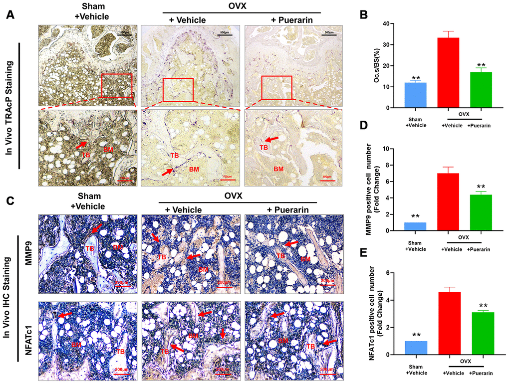 Puerarin treatment reduces the numbers of osteoclasts in the bone tissue of OVX-induced osteoporosis model mice. (A, B) Representative images show the tartrate-resistant acid phosphatase (TRAcP) activity staining in the bone sections from the sham, OVX+vehicle, and OVX+puerarin mice. Also shown is the estimation of the osteoclast surface relative to the bone surface (Oc.S/BS) in the femur bones of the sham, OVX+vehicle, and OVX+puerarin group mice (n=5 per group). Note: **P 0.01 vs. the OVX+vehicle group. (C–E) Representative images show the IHC staining of the femur bone sections from the sham, OVX+vehicle, and OVX+puerarin mice with antibodies against bone resorption markers, MMP9 and NFATc1. Also shown is the quantitative analysis of MMP9- and NFATc1-postive cells in the femur bone sections from the sham, OVX+vehicle, and OVX+puerarin mice (n=5 per group). Note: **P 0.01 vs. the OVX+vehicle group.