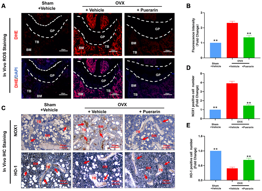 Puerarin treatment reduces ROS levels in the bone tissues of the OVX-induced osteoporosis model mice. (A, B) Fluorescence images show the ROS levels based on DHE staining in the cryosections of femur bone tissues from the sham, OVX+vehicle, and OVX+puerarin mice (n=5 per group). Note: **P 0.01 vs. the OVX+vehicle group. (C–E) Representative images show the IHC staining of the femur bone sections from the sham, OVX+vehicle, and OVX+puerarin mice with antibodies against NOX1 and HO-1. Also shown is the quantitative analysis of NOX1 and HO-1 expression in the bone sections from the sham, OVX+vehicle, and OVX+puerarin mice (n=5 per group). Note: **P 0.01 vs. the OVX+vehicle group.