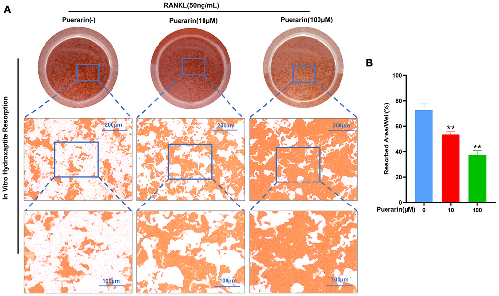 Puerarin suppresses in vitro hydroxyapatite resorption activity of the osteoclasts. (A) Representative images show the total numbers of osteoclasts and the resorption pits formed in the hydroxyapatite resorption assay in the BMMs treated with 50 ng/mL M-CSF, 50 ng/mL RANKL and 0, 10, or 100 μM puerarin. (B) Hydroxyapatite resorption assay analysis showsthe total resorbed hydroxyapatite area in the BMMs treated with 50 ng/mL M-CSF, 50 ng/mL RANKL and 0, 10, or 100 μM puerarin. Note: n=3 per group; **P 0.01 vs. the control group (without puerarin treatment).