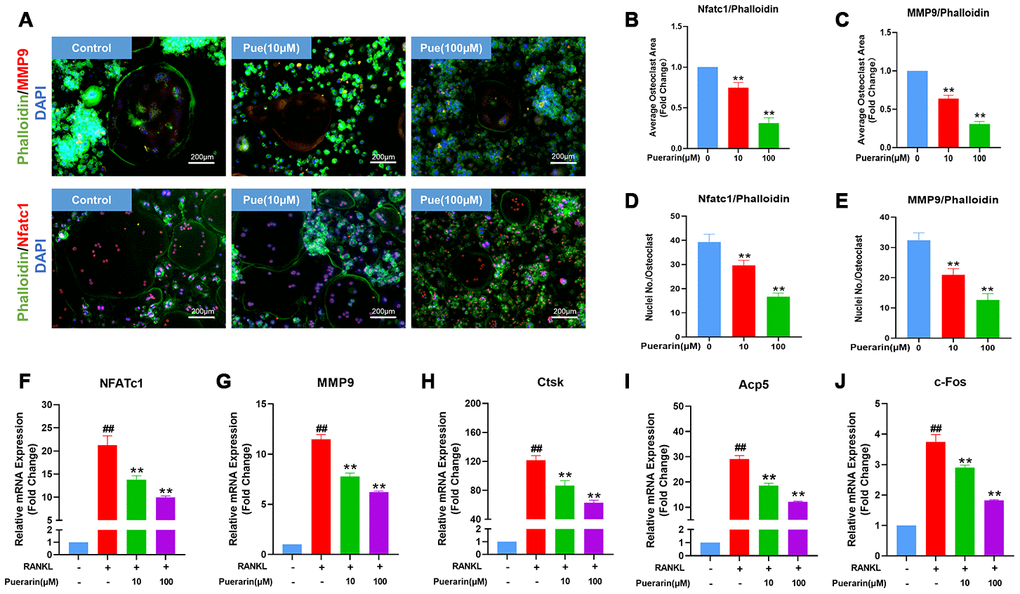 Puerarin reduces F-actin ring formation in the osteoclasts and suppresses osteoclastogenesis-related gene expression. (A) Representative images show the podosome belt formation in the osteoclasts formed from the RANKL and RANKL+ indicated concentrations of puerarin-treated BMMs. The cells were stained with antibodies against MMP9/NFATc1 (red), phalloidin for F-actin (green) and the nuclei were stained with DAPI (blue). (B, C) Quantitative analysis of the F-actin ring area in the osteoclasts from the RANKL and RANKL+ indicated concentrations of puerarin-treated BMMs. Note: n=3 per group, ** P 0.01 vs. the control group (without puerarin treatment). (D, E) Quantitative analysis of the numbers of nuclei per osteoclast in the control BMMs and BMMs induced the RANKL and RANKL+ indicated concentrations of puerarin-treated. Note: n=3 per group; ** P 0.01 vs. the control group (without puerarin treatment). (F–J) QRT-PCR analysis of the mRNA levels of osteoclastogenesis-related genes, NFATc1, MMP9, CTSK, Acp5, and c-Fos, in the control BMMs and BMMs induced with RANKL and RANKL+ indicated concentrations of puerarin. Note: n=3 per group; ##P 0.01 vs. the control group (without RANKL induce and puerarin treatment); ** P 0.01 vs. the RANKL-induced group (without puerarin treatment).