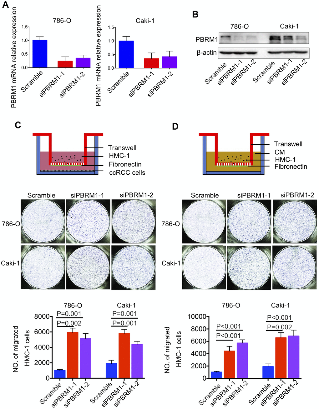 PBRM1-silenced ccRCC cells recruit significantly higher numbers of mast cells in vitro. (A) qRT-PCR and (B) Western blot analysis shows PBRM1 mRNA and protein levels in control and PBRM1-silenced 786-O and Caki-1 cells. (C, D) Transwell migration assay results show the total numbers of migrating HMC-1 cells when co-cultured with control and PBRM1-silenced 786-O and Caki-1 cells or the conditioned media from these cells. The migrating HMC-1 cells are stained with crystal violet and counted. The experiments were performed in triplicate and the results are shown as means±SD. Student’s t-test was used to determine statistical significance.
