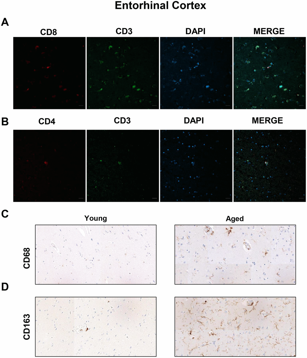 Presence of cytotoxic CD8+ T cells in the entorhinal cortex of aged individuals. (A) Co-immunofluorescence of CD8 with CD3 marker (n=4). (B) Co-immunofluorescence of CD3 with CD4 marker (n=4). Cell nuclei were counterstained with DAPI. Scale bar: 20 μm. (C, D) Representative images of CD68 and CD163 microglia markers in young and aged individuals (n=3). Images were obtained using the 20× objective.