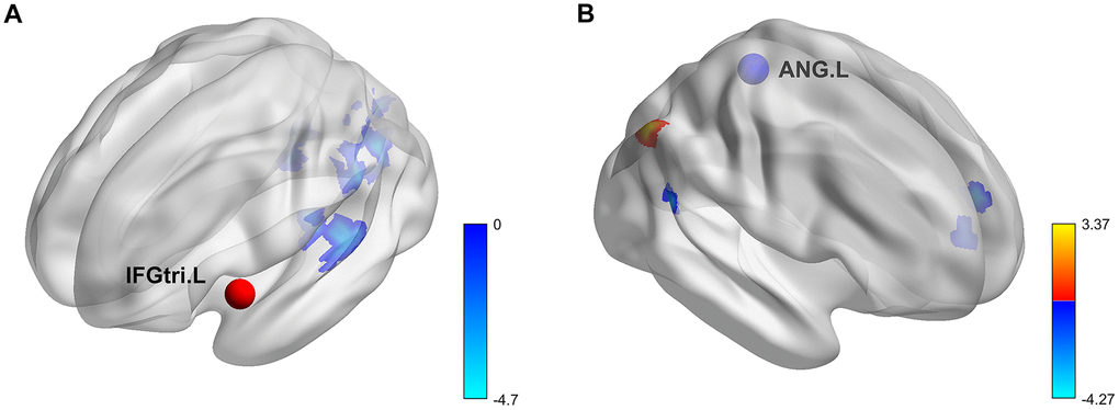 Rendering of regions with significant COMT genotype and sex effects on task-based background functional connectivity. (A) Seed region, IFGtri.L. (B) Seed region, ANG.L. All results were corrected at voxel-level p COMT genotype effect; cool color, sex effect.