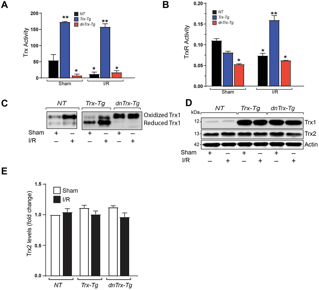 High amounts of hTrx in transgenic mice prevents I/R mediated redox shift, and loss of Trx and Trx reductase activities. (A) Trx activity was assayed in myocardium derived from sham and I/R-subjected NT, Trx-Tg, and dnTrx-Tg mice and expressed as nanomoles of NADPH oxidized per minute per milligram of protein at 25°C. Values are represented as means ± SEM (n =3-4). *p NT or dnTrx-Tg. (B) TrxR activity in sham or I/R myocardium were expressed as micromoles of 5-thio-2-nitrobenzene (TNB) formed per minute per milligram of protein at 30°C. Values are represented as means ± SEM (n =3-4). *p NT or dnTrx-Tg I/R. (C) Redox Western blot analysis revealing the redox state of Trx (oxidized and reduced) in sham or I/R myocardium from NT, Trx-Tg and dnTrx-Tg mice. (D) AAR region of sham or I/R myocardium from NT, Trx-Tg and dnTrx-Tg were lysed using M-PER lysis buffer and analyzed for Trx1, Trx2 and Actin by western blotting. (E) Trx2 levels were quantified and expressed as fold change. Statistical significance was determined with one-way ANOVA followed by Tukey’s post-hoc multiple comparisons test.