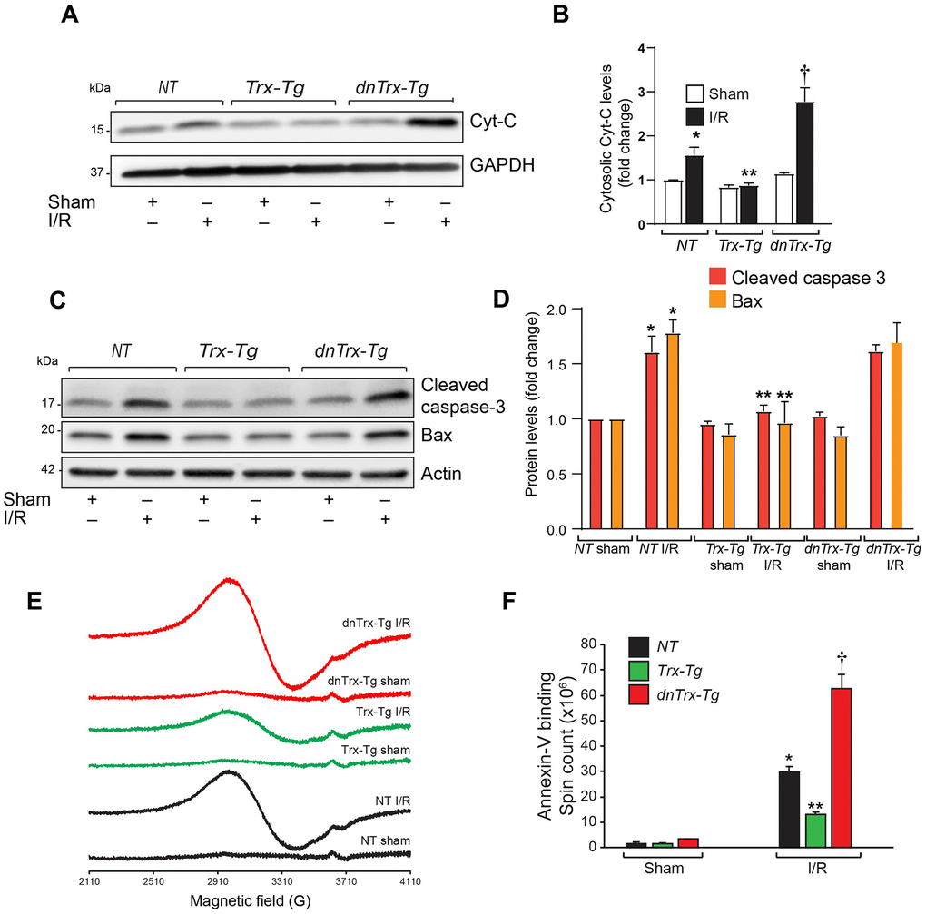 High level of Trx protects against I/R- induced apoptosis. (A) Cytosolic extract was prepared from AAR region of sham or I/R subjected NT, Trx-Tg and dnTrx-Tg mice and level of Cyt-C was analyzed by western blotting. (B) Levels of cytosolic Cyt-C was quantified and expressed as fold change. *p NT sham; **p NT or dnTrx-Tg I/R; † p NT or Trx-Tg I/R. (C) AAR region of sham or I/R myocardium from NT, Trx-Tg and dnTrx-Tg were lysed using M-PER lysis buffer and analyzed for cleaved caspase 3 and Bax by western blotting. (D) Protein levels were quantified and expressed as fold change. *p NT sham; **p NT or dnTrx-Tg I/R hearts, n=3. (E) EPR spectra of paramagnetic iron bound Annexin-V. (F) Graph shows an absolute spin count of Fe-Annexin-V. Values are means ± SD (n = 3 mice). *, p NT Sham; **, p NT I/R or dnTrx-Tg I/R; † p NT or Trx-Tg I/R. Statistical significance was determined with the Student’s t test (B, D) and one-way ANOVA followed by Tukey’s post-hoc multiple comparisons test (F).