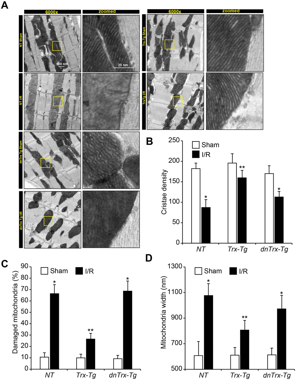 High level of Trx prevents I/R-induced mitochondrial cristae and DNA damage. (A) Ultrastructural analysis of sham or I/R hearts from NT, Trx-Tg and dnTrx-Tg. Representative transmission electron microscopic images showing cristae structure and density. Calculated cristae density (B), percent damaged mitochondria (loss of ≥50% cristae density) (C), and width of mitochondria (D) and plotted as bar graph. Values are means ± SD (n = 25). *, p NT or Trx-Tg IR.