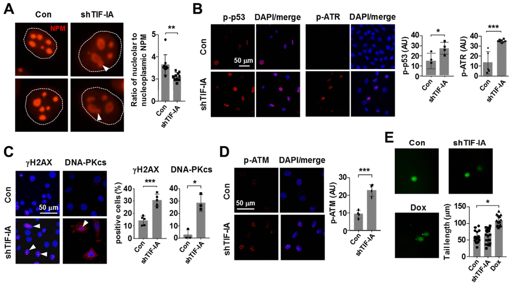 Nucleolar stress elicited a DNA damage response in vascular SMCs (MOVAS). (A) Immunofluorescence staining for nucleophosmin (NPM) showing that TIF-IA silencing triggered a nucleolar stress response as evidenced by the appearance of nucleolar caps (arrowheads) and redistribution of NPM from nucleoli to the nucleoplasmic space. Single nuclei were outlined by the dashed line. The graph on the right showed changes in the ratio of nucleolar to nucleoplasmic NPM fluorescence intensity (n = 9 - 10). (B) Immunofluorescence images and semi-quantitative mean intensity data expressed in arbitrary units (AU) showing the increased phosphorylations of p53 and ATR in TIF-IA-silenced cells (n = 3 - 8). Nuclei were counterstained with DAPI (blue). (C) Immunofluorescence images and quantitative data showing accumulation of γH2AX and DNA-PKcs foci (arrowheads) in the nuclei of TIF-IA-silenced cells (n = 3 - 5). (D) Immunofluorescence and the mean intensity data showing the increased phosphorylation of ATM in TIF-IA-silenced cells (n = 4). (E) Alkaline comet assay results showing that TIF-IA knockdown did not cause massive DNA breaks (n = 17 cells measured). Doxorubicin (Dox, 1 μM) was used as a positive control. Data were mean ± S.D. * P P P t-test or one-way ANOVA as appropriate.