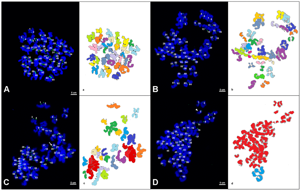 (A–D) Representative maximum projection of chromosome spreads for euploid and aneuploid MII oocytes from young and old mares. Green, kinetochores (CREST); blue, chromatin (Hoechst). (a–d) explanatory drawing of the chromosome spreads. Different sister chromatid pairs have different colors. For the chromatids colored in red, it was not possible to distinguish single pairs and they were therefore used only for ploidy assessment and not for interkinetocore distance measurement. A total of 64 CREST positive foci (32 pairs of sister chromatid kinetochores) are shown in an euploid MII oocyte from a young mare (A) and an old mare (B). (C) A total of 63 CREST positive foci are displayed in an aneuploid MII oocyte from an old mare; the white arrow indicates an uneven and unpaired kinetochore. (D) A total of 60 CREST positive foci are seen in an aneuploid MII oocyte from an old mare; the arrow head indicates an unpaired kinetochore. Bar, 5μm.