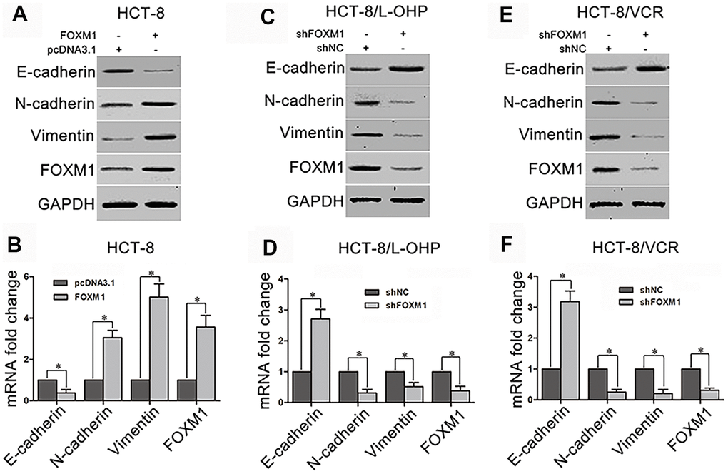 The effect of FOXM1 on expression of EMT-associated marker. The protein and mRNA levels of E-cadherin, N-cadherin, Vimentin, and FOXM1 in HCT-8 cells transfected with pcDNA3.1 or pcDNA3.1-FOXM1 for 72 h (A, B), HCT-8/L-OHP and HCT-8/VCR cells transfected with shNC or shFOXM1 for 72 h (C–F). Cell extracts of each sample were prepared and analyzed for protein expression by Western blotting or for mRNA expression by qRT-PCR. For the western blotting, each immunoblot is representative of three separate experiments. For the qRT-PCR, the relative mRNA expression levels were normalized to the fold change that was detected in the corresponding control cells, which was defined as 1.0. Data are expressed as mean ± SD of three independent experiments. *P 