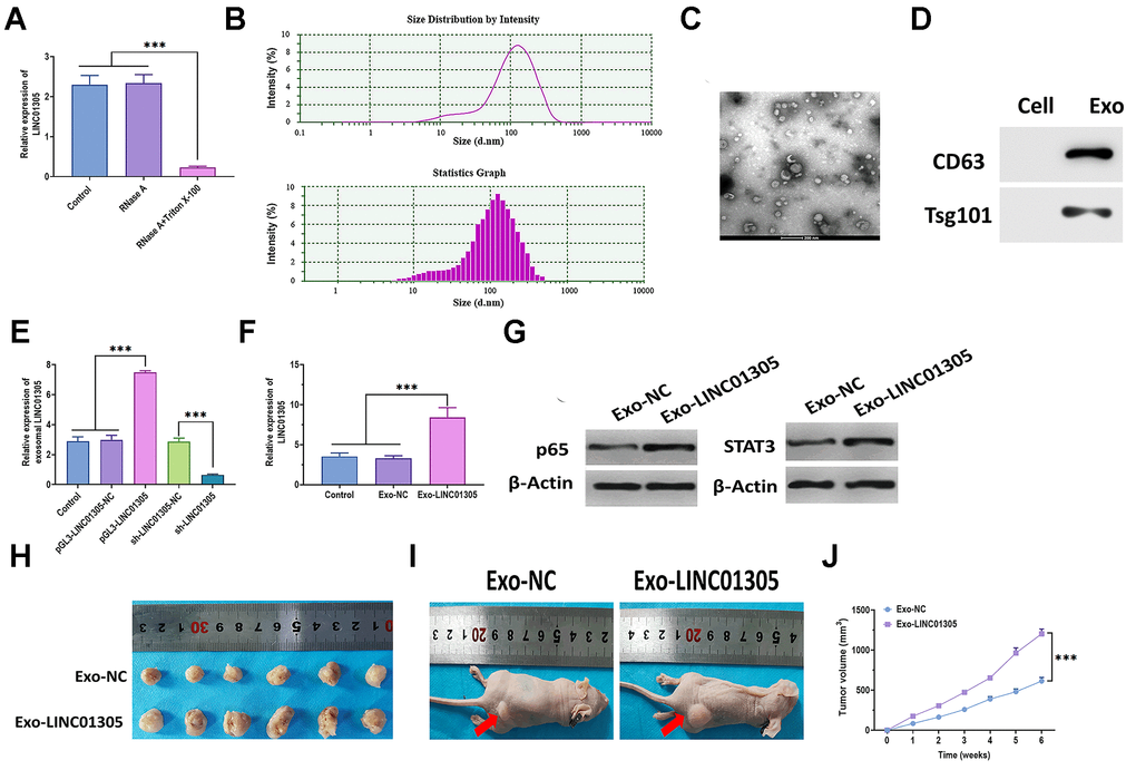 Exosomal LINC01305 promotes the progression of CC. (A) Expression of LINC01305 in C-33A cells treated with RNase A or RNase A plus Triton X-100. (B) Nanoparticle tracking analysis for the number and size of exosomes. (C) Transmission electron microscopy for the morphology of exosomes. Scale bar = 200 μm. (D) Protein expressions of exosomal surface markers. (E) Expression of LINC01305 of exosomes derived from C-33A cells with overexpression or silencing of LINC01305. (F) Expression of LINC01305 in C-33A cells cocultured with exosomes derived from C-33A cells with overexpression of LINC01305. (G) Protein expressions of p65 and STAT3 in C-33A cells cocultured with exosomes derived from C-33A cells with overexpression of LINC01305. (H, I) Representative image of tumor tissues and xenograft mice treated with exosomes derived from C-33A cells with overexpression of LINC01305. (J) Tumor volume of xenograft mice treated with exosomes derived from C-33A cells with overexpression of LINC01305. * P P P 