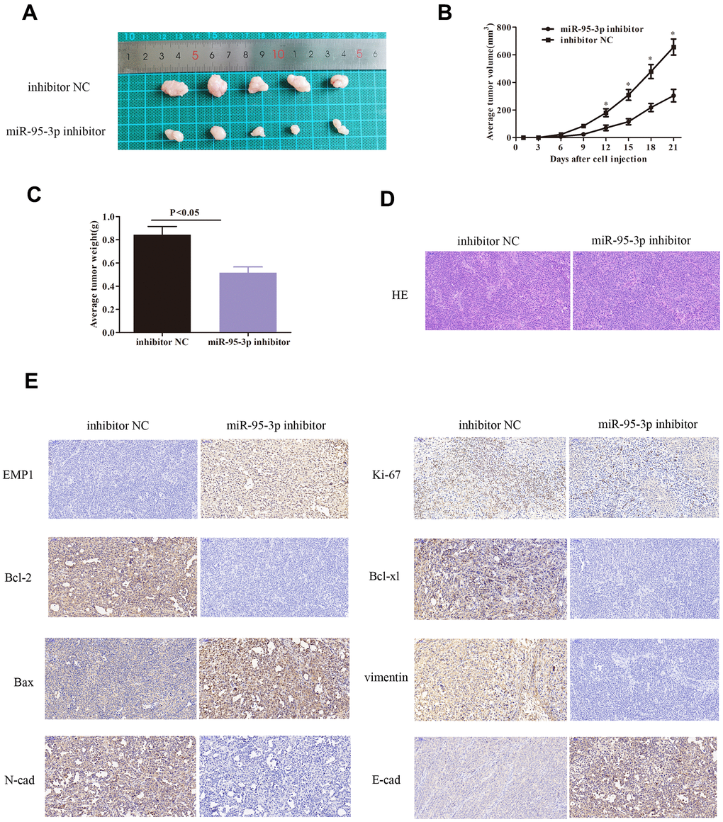 Down-regulation of miR-95-3p induced slower tumor growth in vivo via decreased expression of oncogenes, inhibiting the EMT process, and down-regulation of drug-resistance proteins. (A) Tumor volume was lower upon treatment with miR-95-3p inhibitor after 21 days of treatment. (B) Tumor volume escalated at a slower rate in the miR-95-3p inhibitor treated group. (C) Lower tumor weight occurred in the miR-95-3p inhibitor-treated group. (D) H&E staining of the tumor. (E) Immunohistochemical staining result of different proteins.