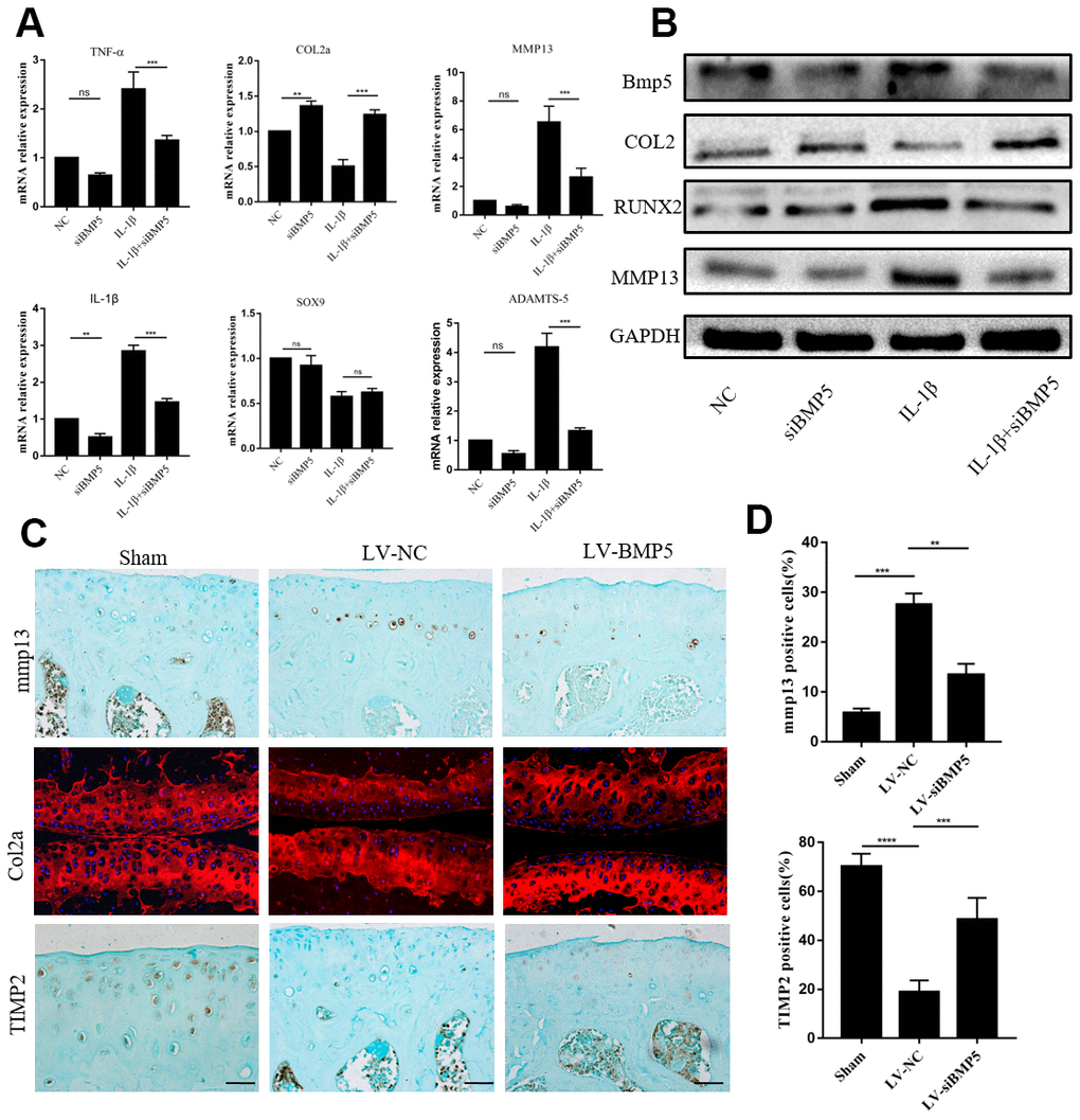BMP5 regulates in vivo and in vitro chondrocyte catabolism. (A) QRT-PCR assay results show mRNA expression levels of pro-inflammatory cytokines (TNF-α, IL-1β), anabolic factors (type II collagen and SOX9), and catabolic factors (MMP13 and ADAMTS-5) in control and BMP-knockdown murine chondrocytes, treated with IL-1β or not. (B) Representative western blots show expression levels of MMP13, Runx2, and Col2 proteins in control and BMP-knockdown murine chondrocytes. (C) Representative immunohistochemical images and (D) quantitative analyses of the IHC results show MMP13, Col2a, and TIMP2 expression in the knee articular cartilage sections from sham-operated, DMM plus LV-siNC, and DMM plus LV-siBMP5 groups of mice at 4 weeks post-DMM operation. All data are represented as means ± SD (n=5 per group).