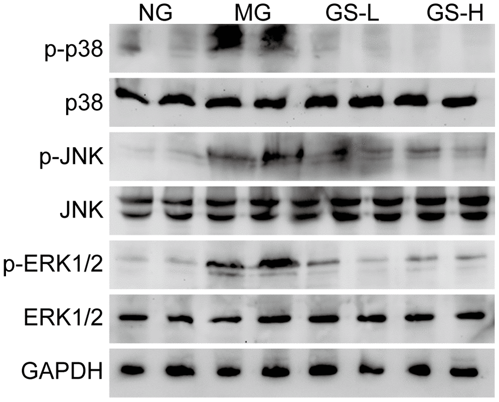 Effects of GSLS on MAPKs signaling pathway in testes of D-gal-induced mice. n=3 per group. NG: normal group, MG: D-gal model group, GS-L: D-gal + low dosage of GSLS group, GS-H: D-gal + high dosage of GSLS group.