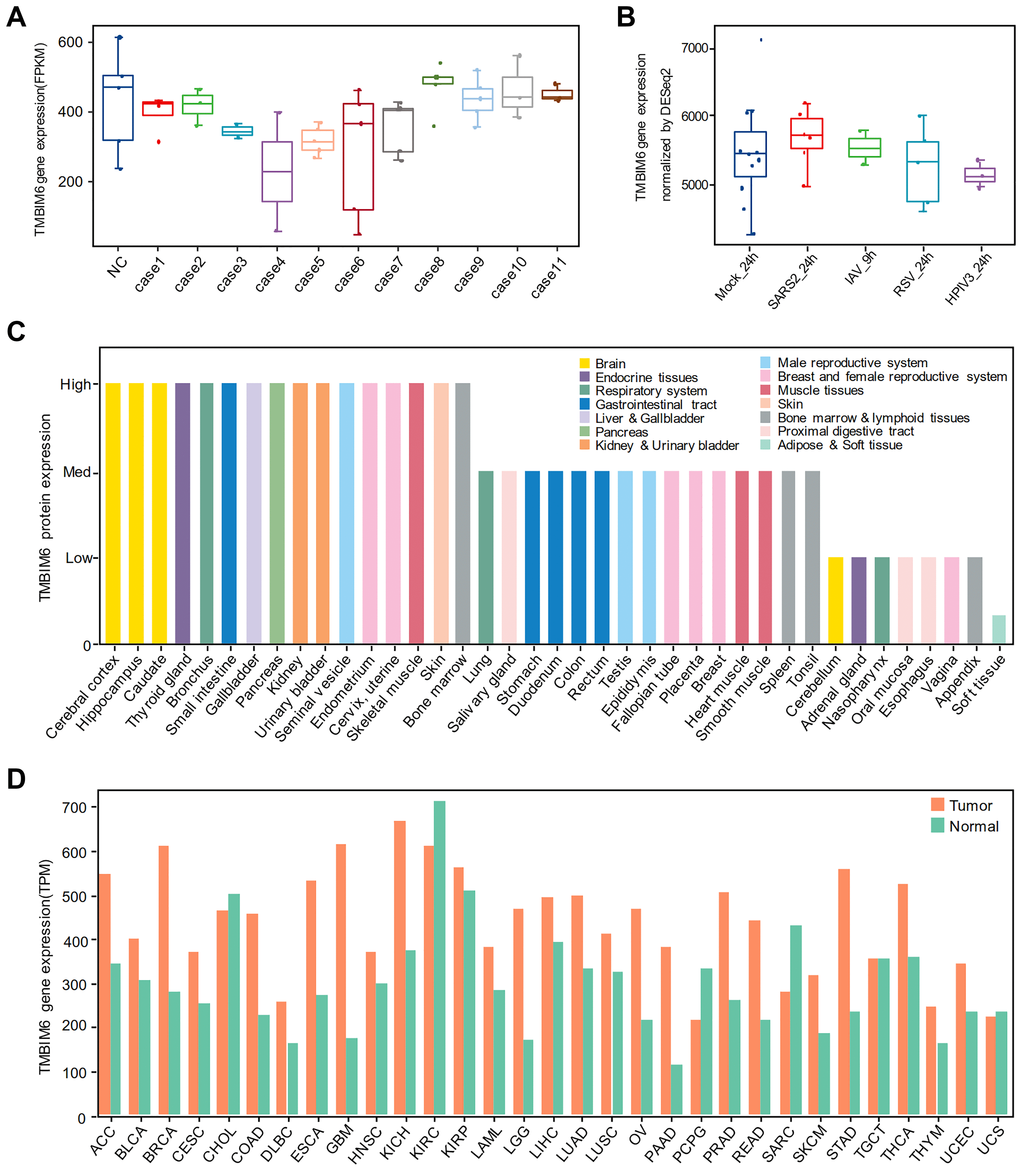 The expression of TMBIM6 in different human tissues and A549 cells infected with different viruses. (A) Nondifferential expression for TMBIM6 gene in autopsied lungs from patients who died from SARS-CoV-2 infection. (In all the cases, P value > 0.05, comparison to negative control). (B) Nondifferential expression for TMBIM6 gene in cells infected with different viruses at 24 h or 9 h. (P value > 0.05, comparison to mock control). (C) The protein expression of TMBIM6 in different human tissues from the HPA database. (D) The gene expression of TMBIM6 in tumor and normal tissues from the GEPIA2 database at the transcriptional level.